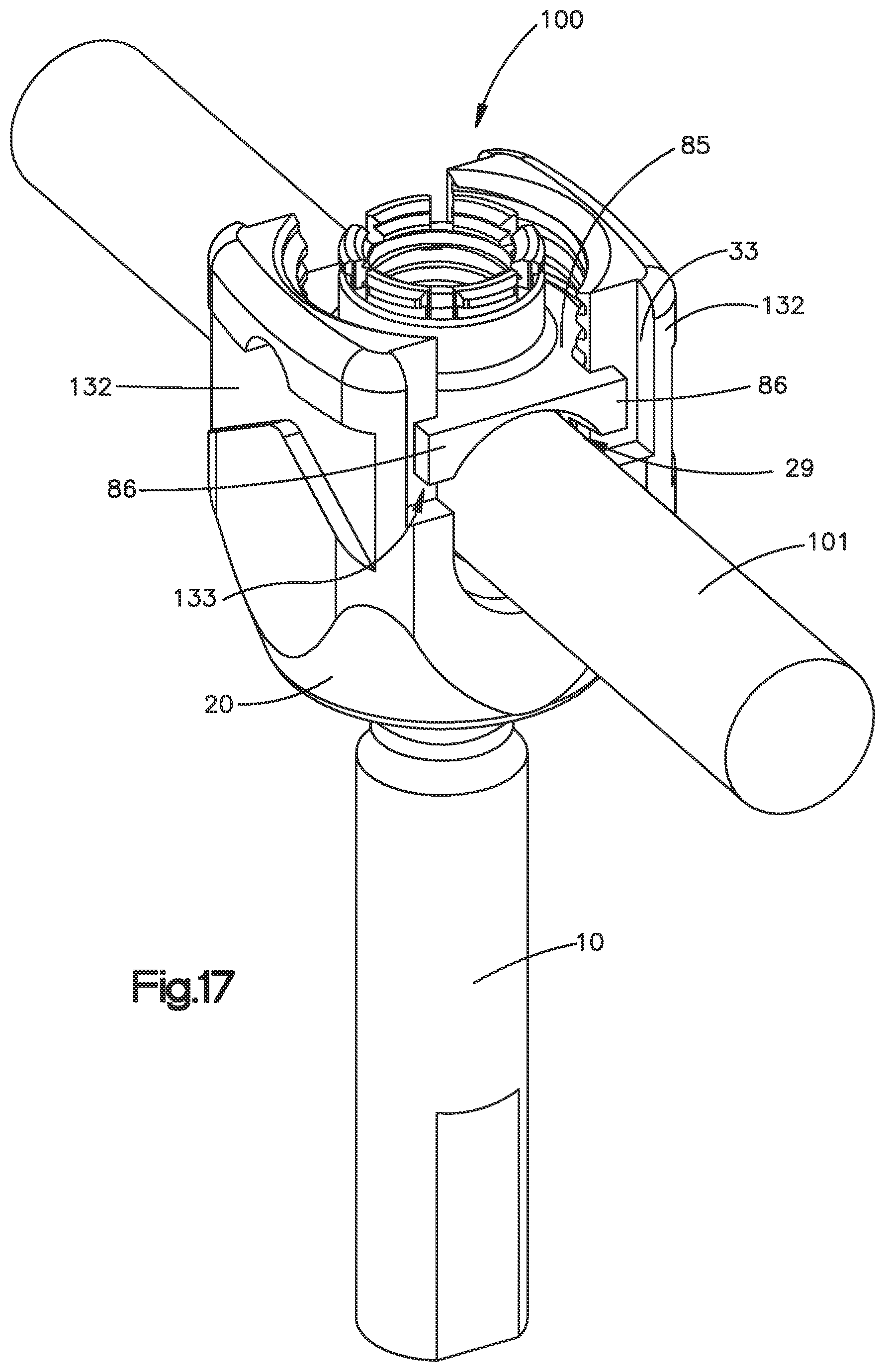 Patent US11812998 Figure 15 – Bone fixation assembly