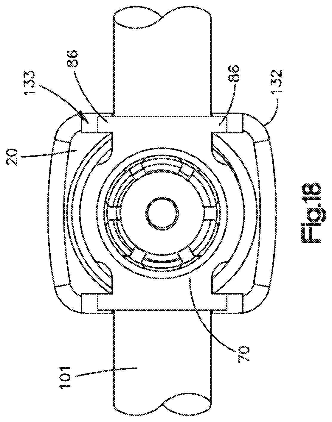 Patent US11812998 Figure 16 – Bone fixation assembly