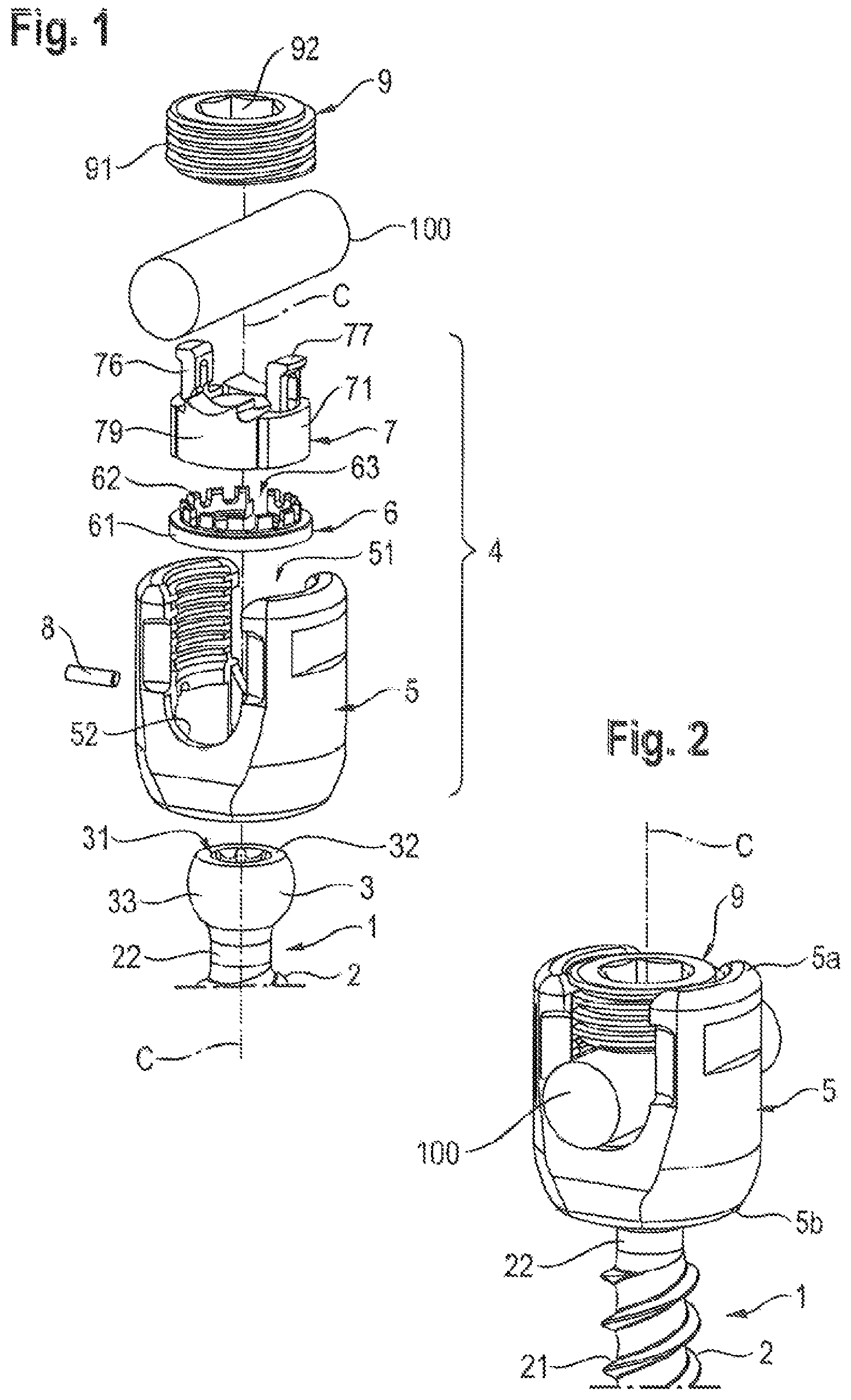 Patent US11812999 Figure 1 – Coupling assembly and polyaxial bone anchoring device comprising the same