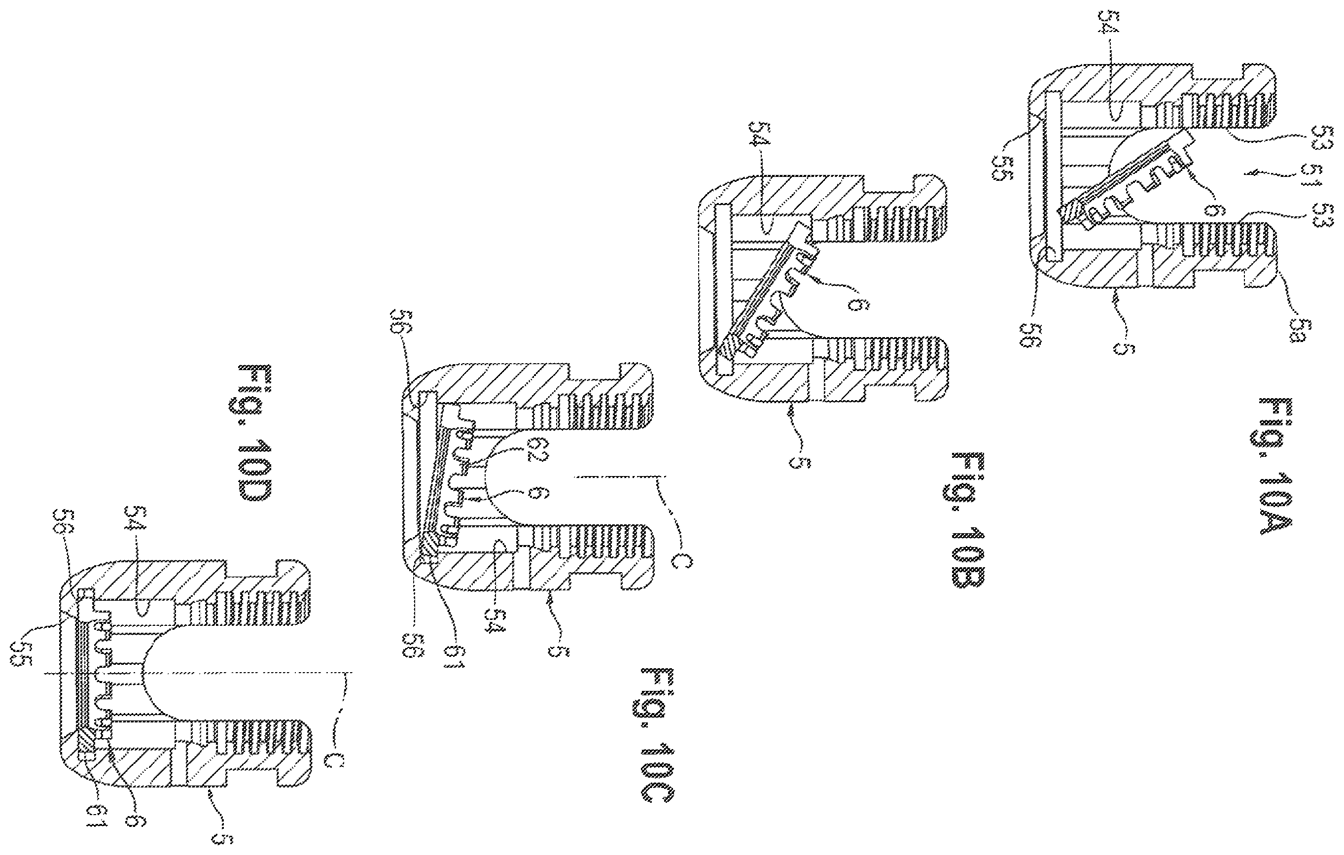 Patent US11812999 Figure 5 – Coupling assembly and polyaxial bone anchoring device comprising the same