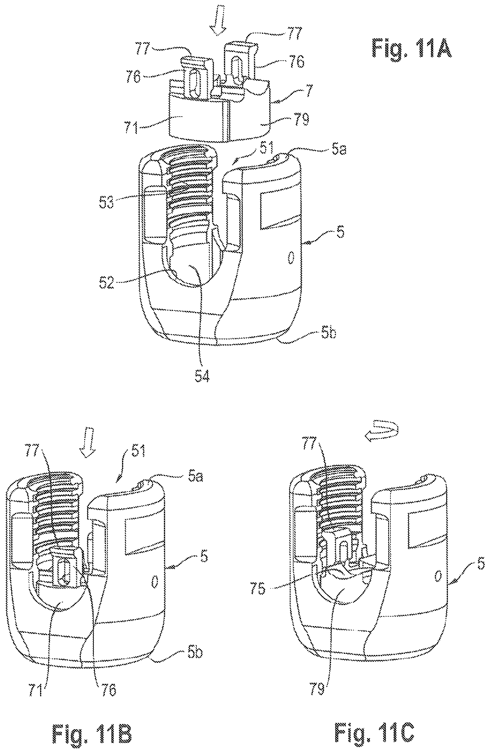 Patent US11812999 Figure 6 – Coupling assembly and polyaxial bone anchoring device comprising the same