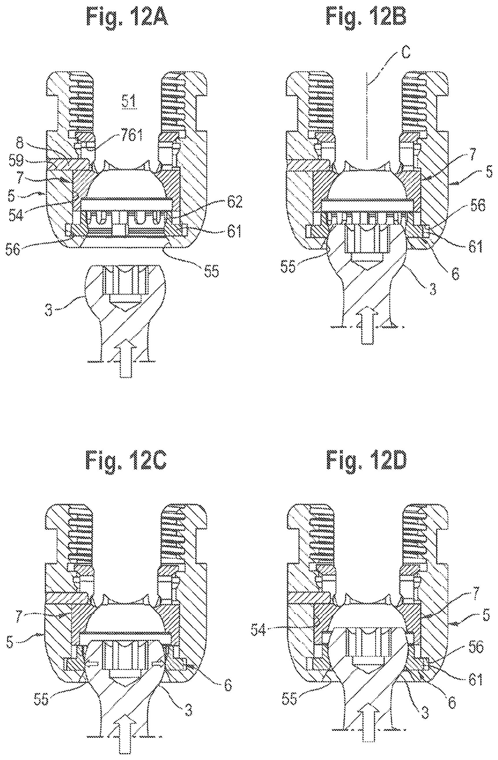 Patent US11812999 Figure 7 – Coupling assembly and polyaxial bone anchoring device comprising the same