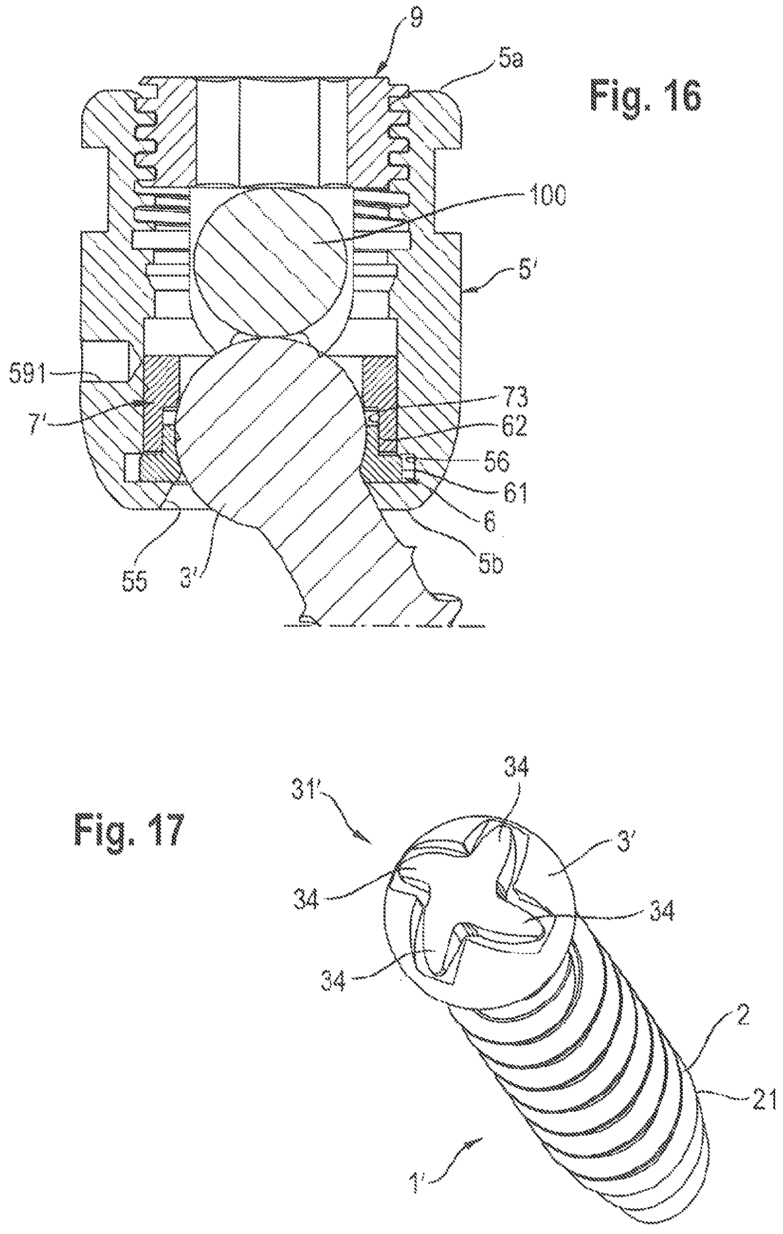 Patent US11812999 Figure 10 – Coupling assembly and polyaxial bone anchoring device comprising the same