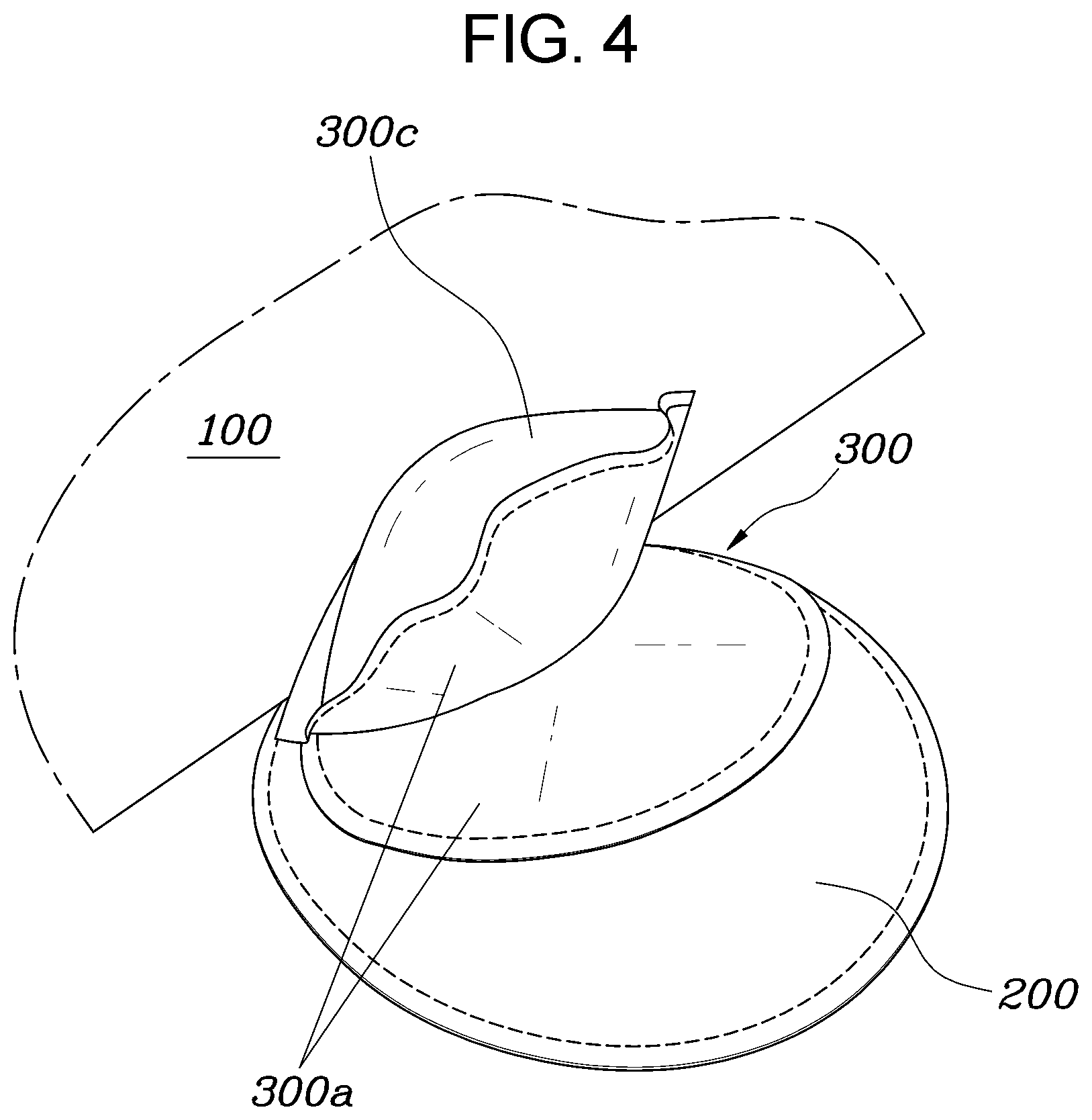 Patent US11814007 Figure 4 – Airbag device and method for manufacturing airbag cushion