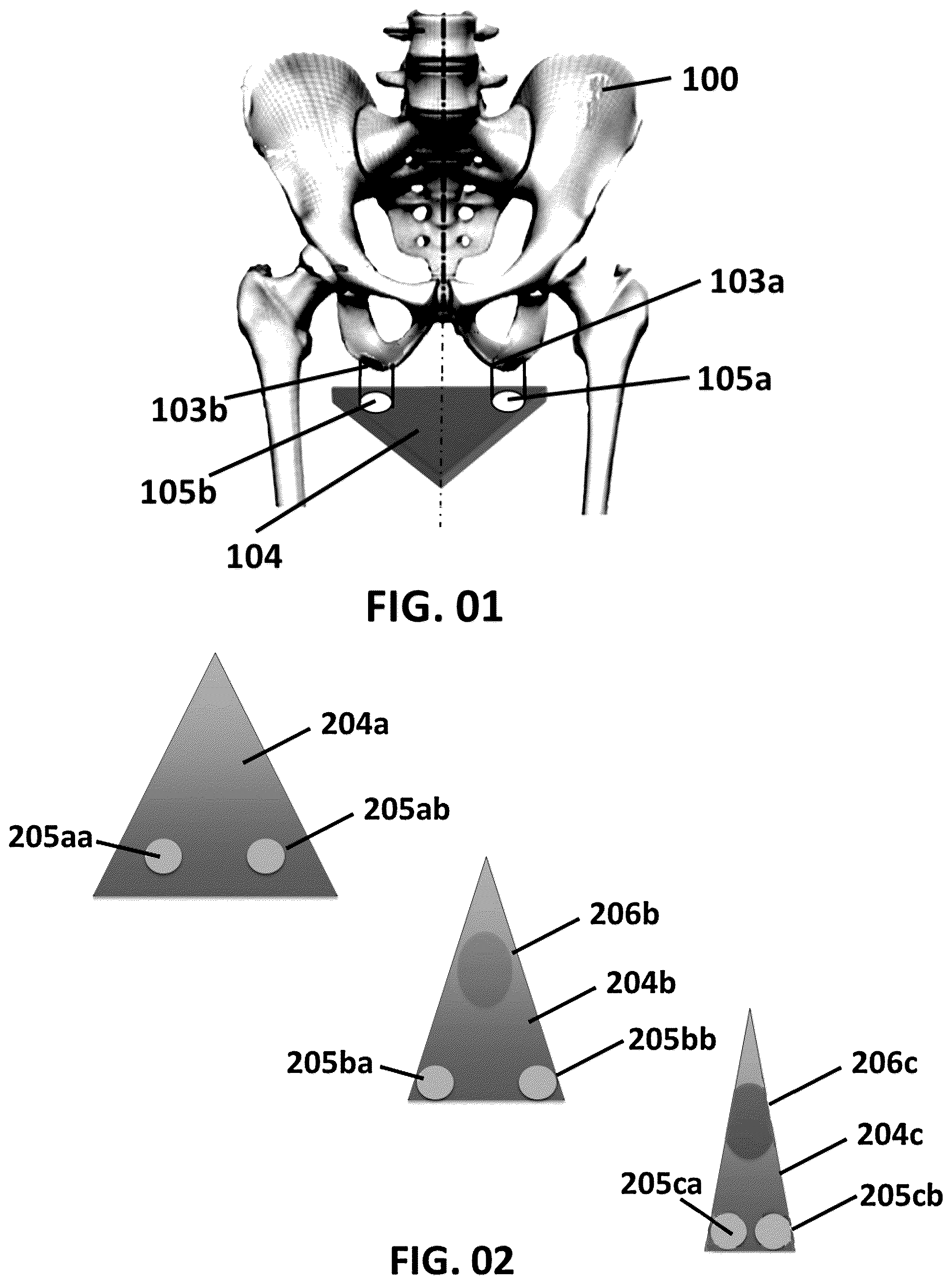 Patent US11814123 Figure 1 – Ergonomically designed bicycle saddle