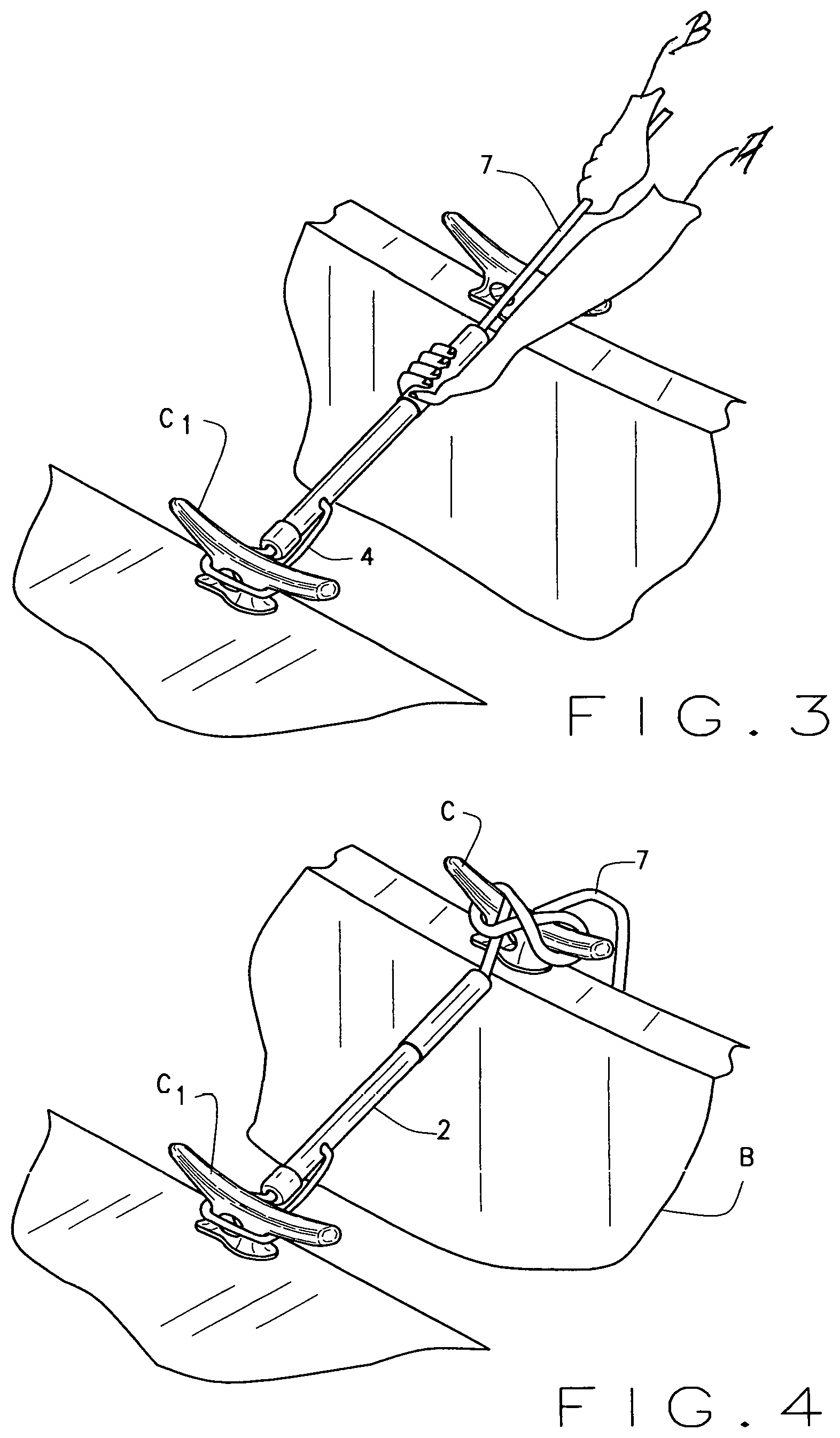 Patent US11814141 Figure 2 – Boat tie down apparatus