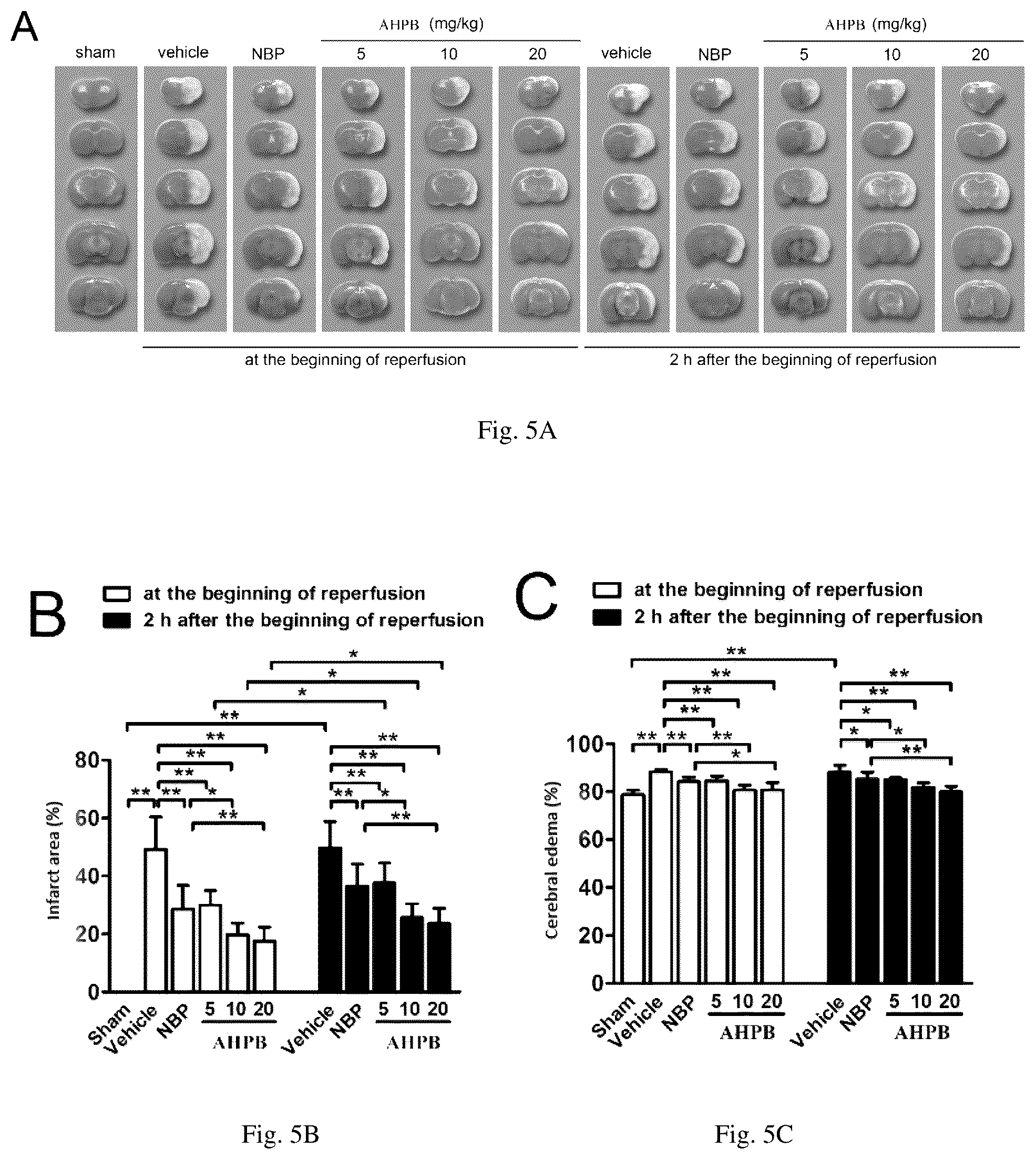 Patent US11814352 Figure 4 – Salts formed by 2-(1-acyloxy-n-pentyl) benzoic acid and basic amino acid or aminoguanidine, and preparation method and application thereof