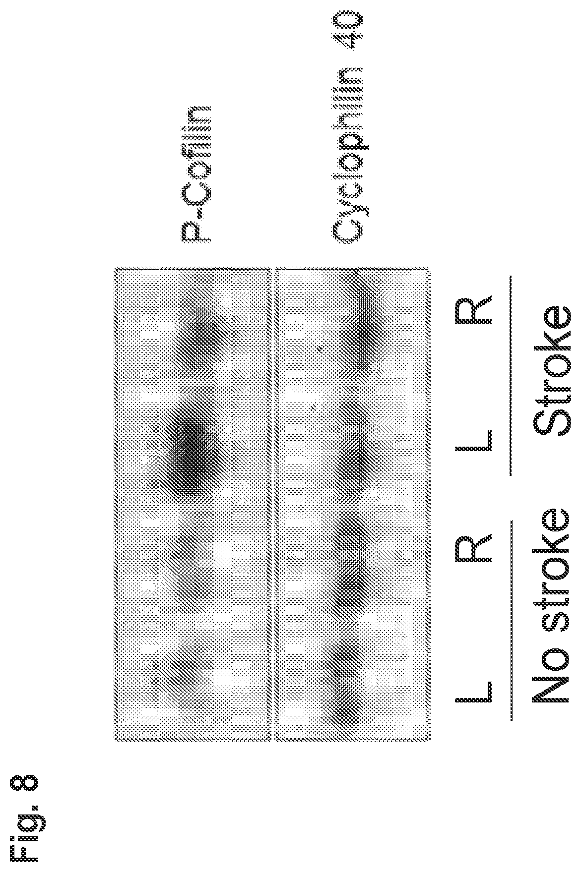 Patent US11814361 Figure 8 – Rho kinase inhibitor BA-1049 (R) and active metabolites thereof