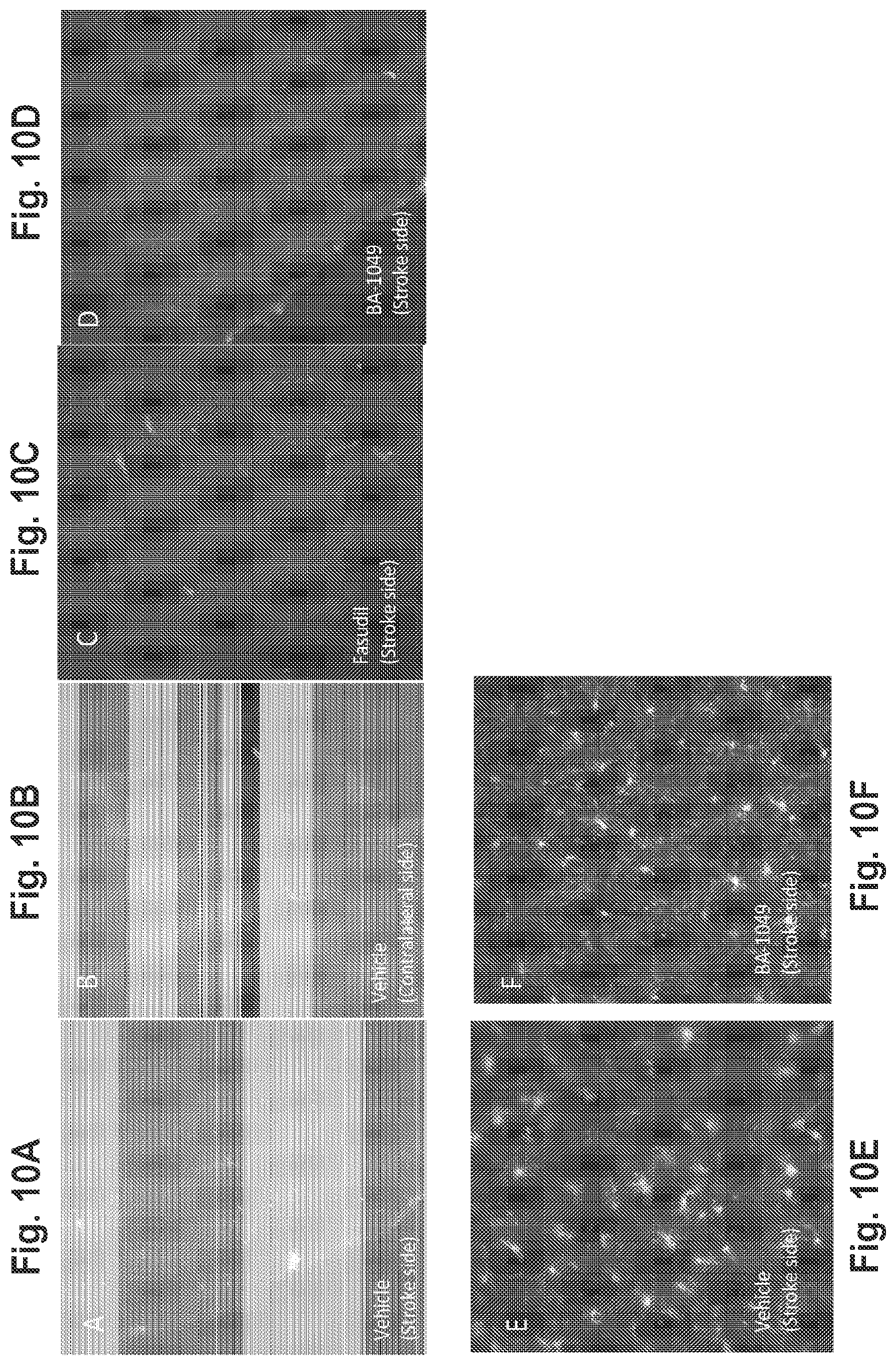 Patent US11814361 Figure 10 – Rho kinase inhibitor BA-1049 (R) and active metabolites thereof