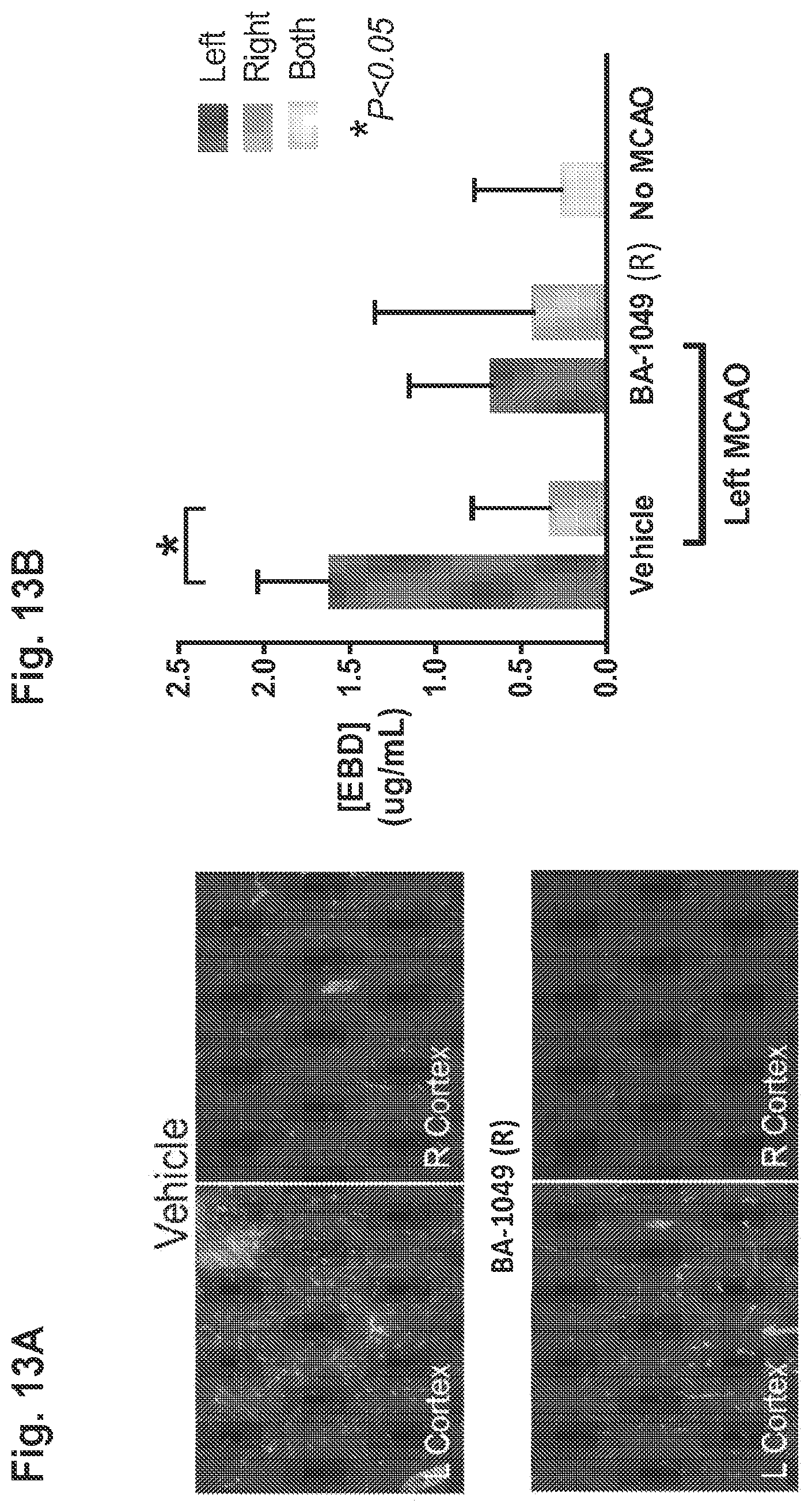 Patent US11814361 Figure 13 – Rho kinase inhibitor BA-1049 (R) and active metabolites thereof