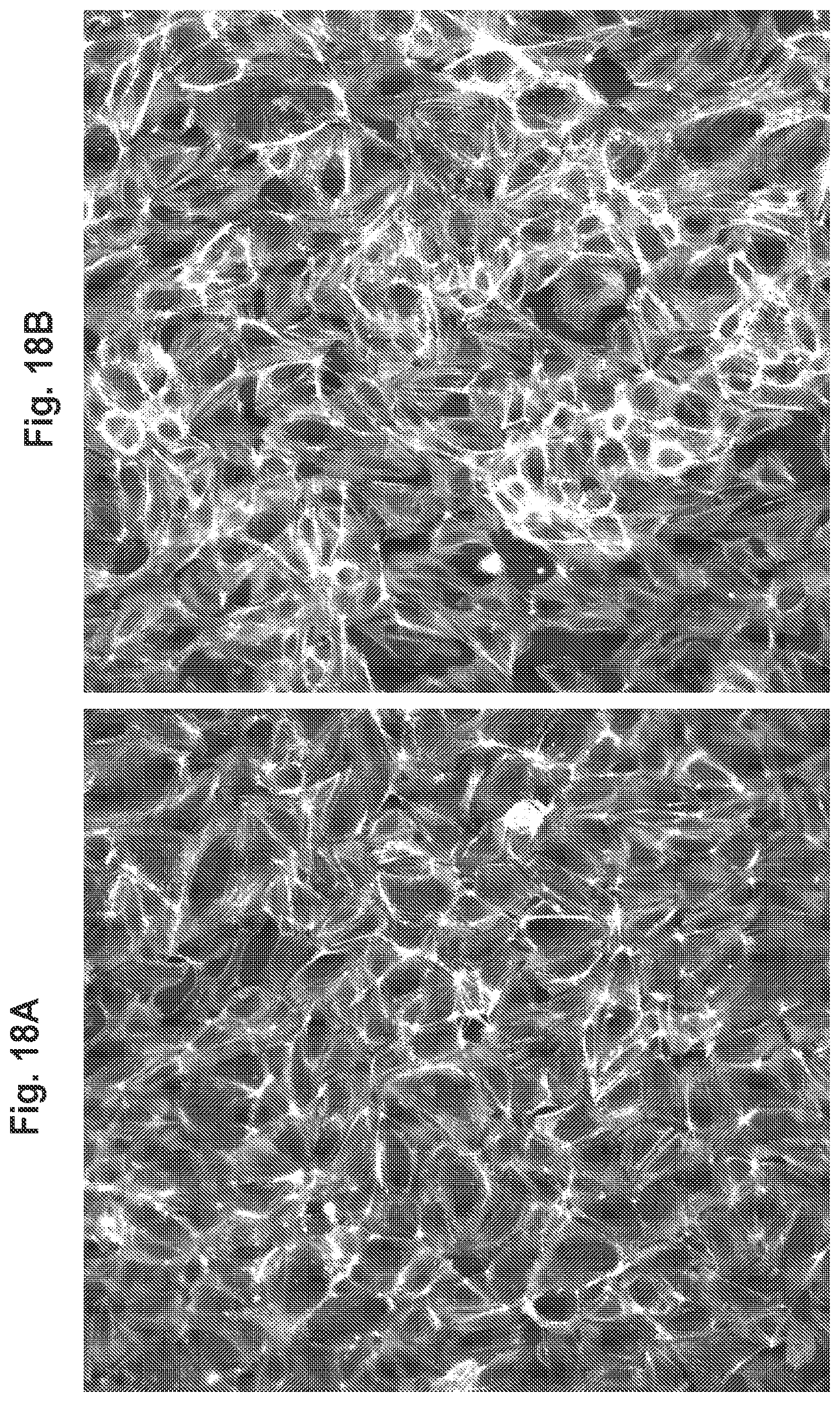 Patent US11814361 Figure 18 – Rho kinase inhibitor BA-1049 (R) and active metabolites thereof
