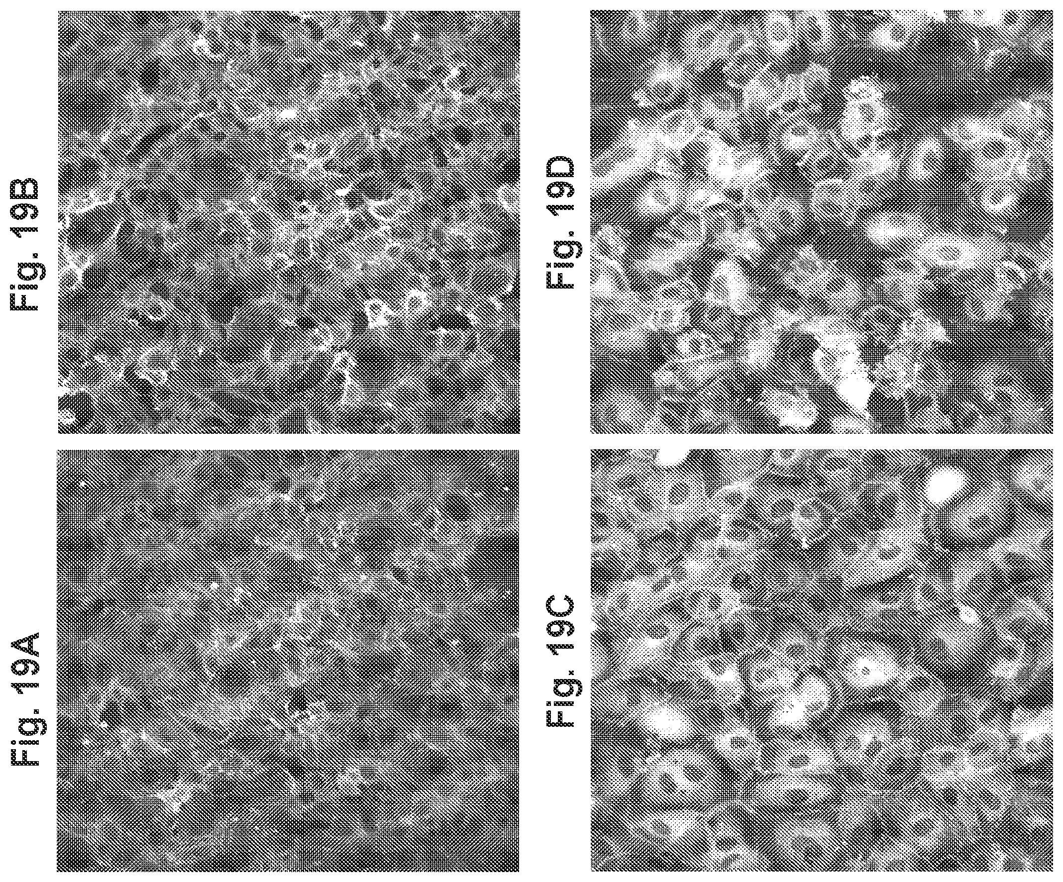 Patent US11814361 Figure 19 – Rho kinase inhibitor BA-1049 (R) and active metabolites thereof