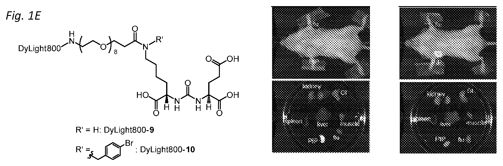 Patent US11814365 Figure 2 – PSMA targeted fluorescent agents for image guided surgery