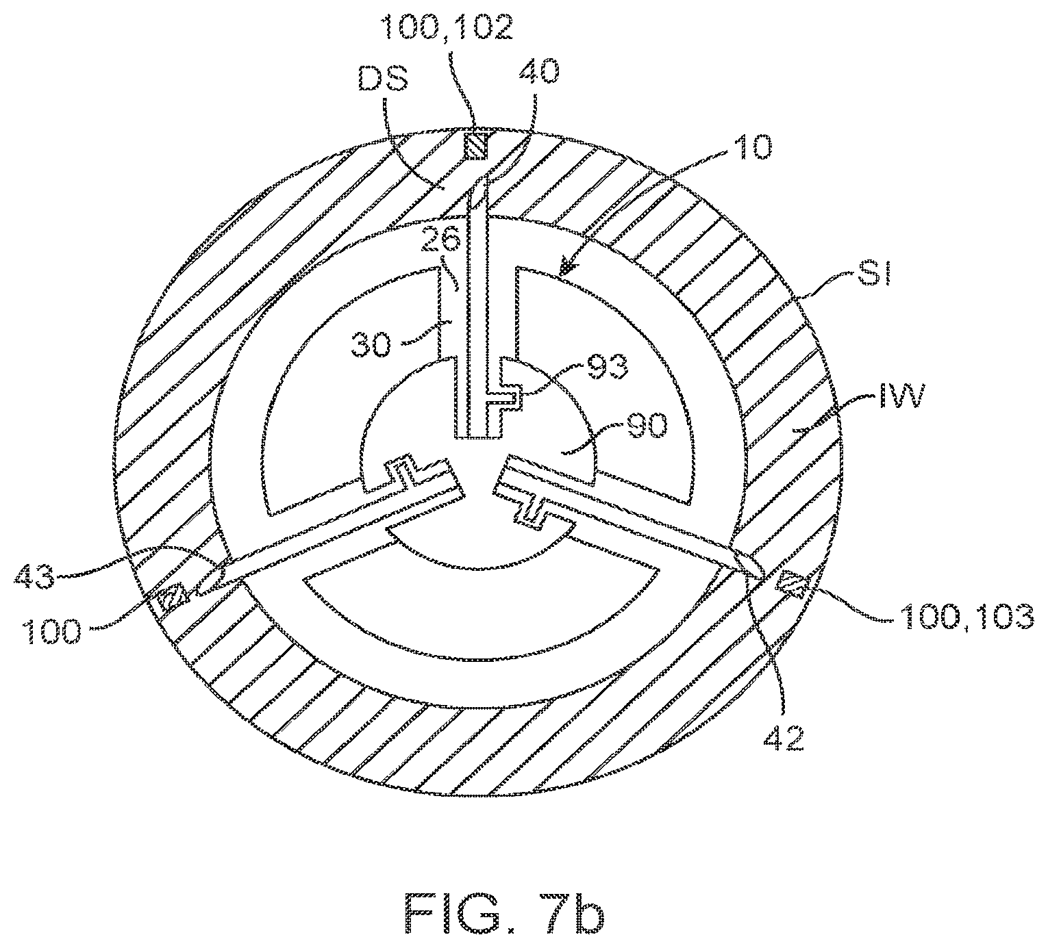 Patent US11814427 Figure 11 – Therapeutic agent preparations for delivery into a lumen of the intestinal tract using a swallowable drug delivery device