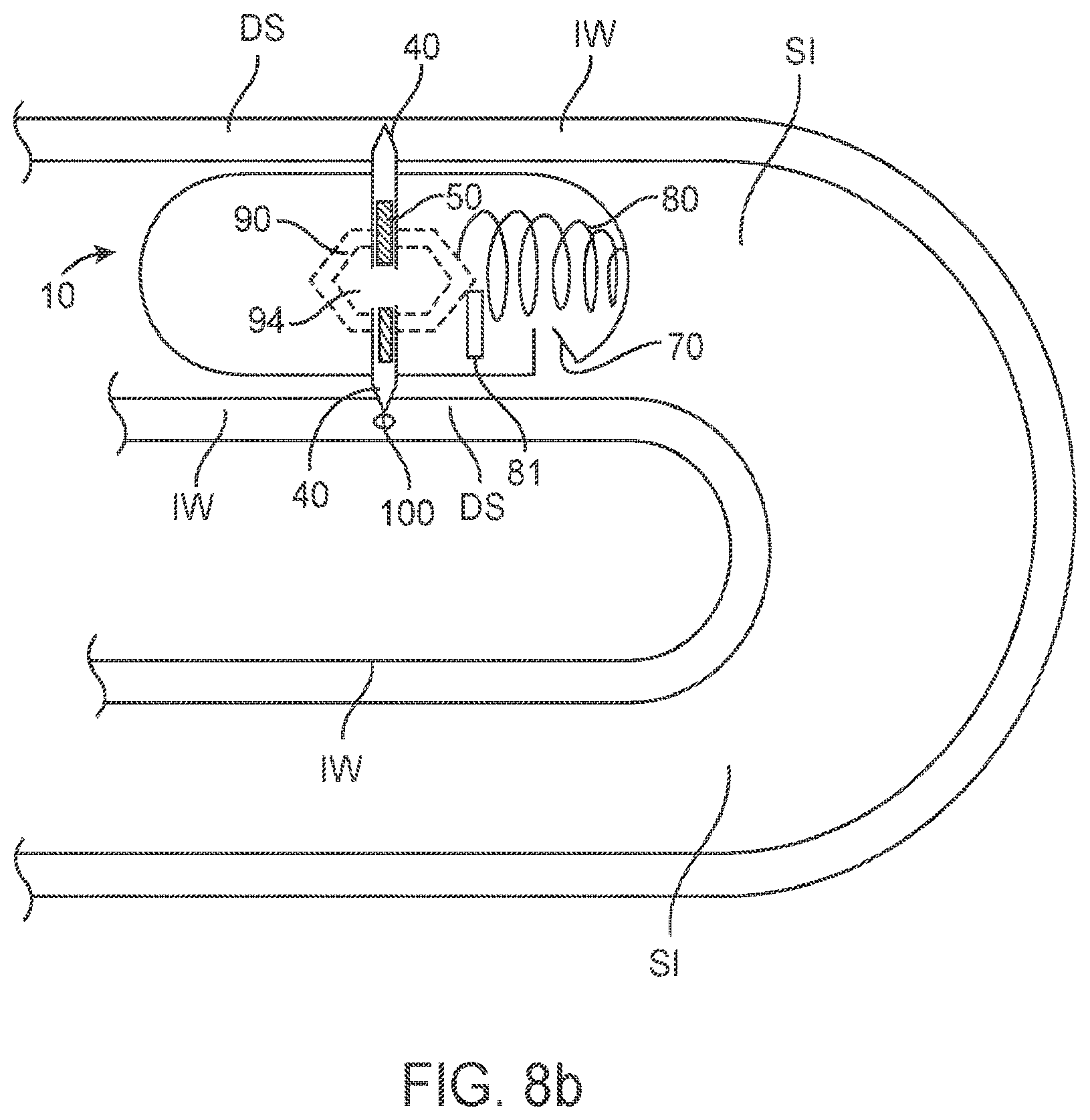 Patent US11814427 Figure 13 – Therapeutic agent preparations for delivery into a lumen of the intestinal tract using a swallowable drug delivery device