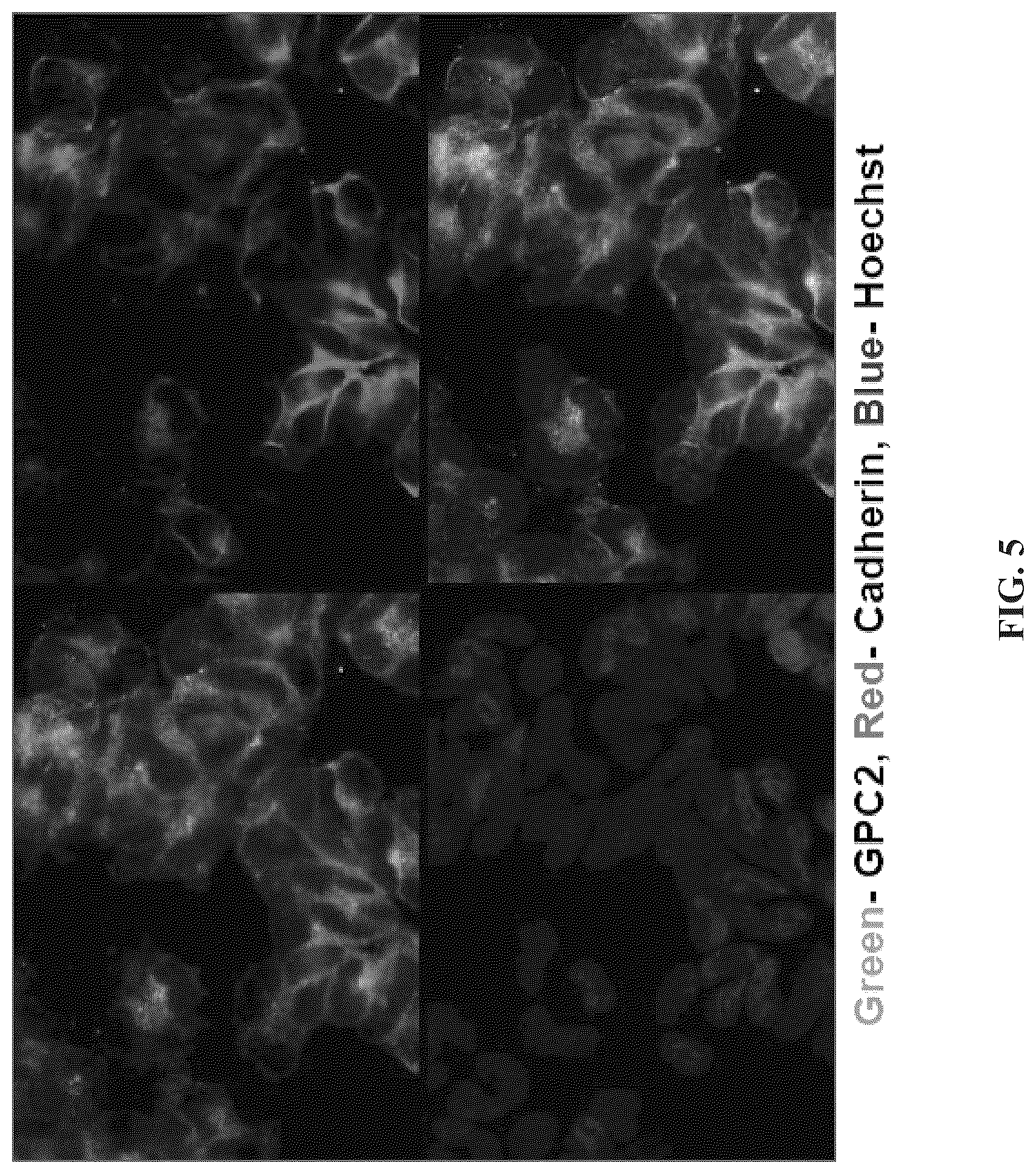 Patent US11814440 Figure 5 – Glypican 2 as a cancer marker and therapeutic target