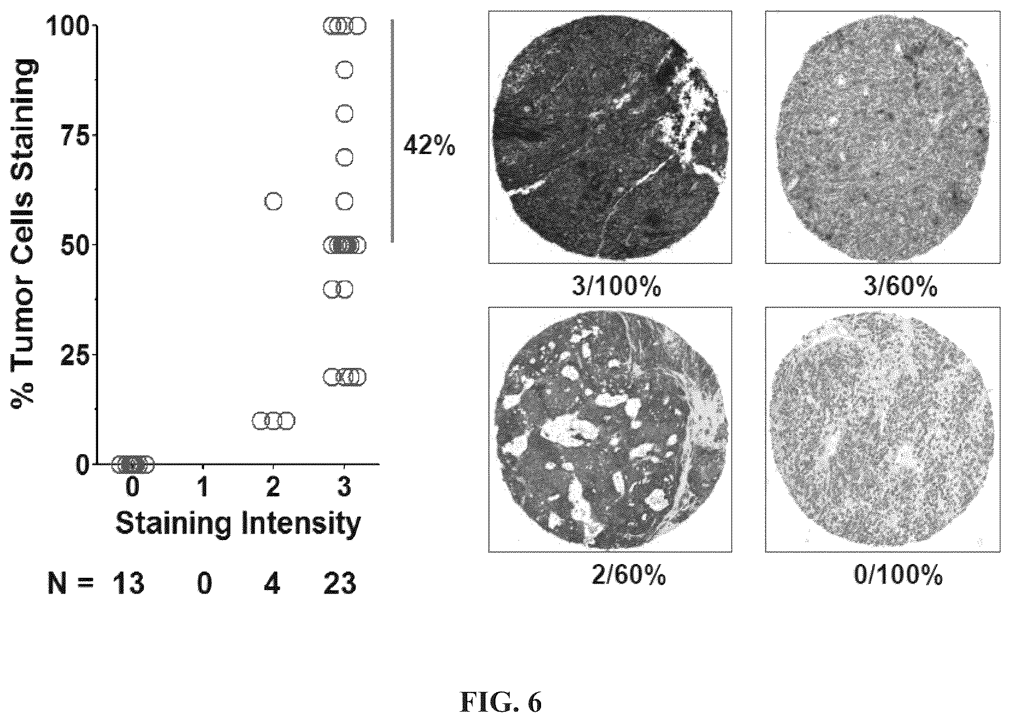 Patent US11814440 Figure 6 – Glypican 2 as a cancer marker and therapeutic target