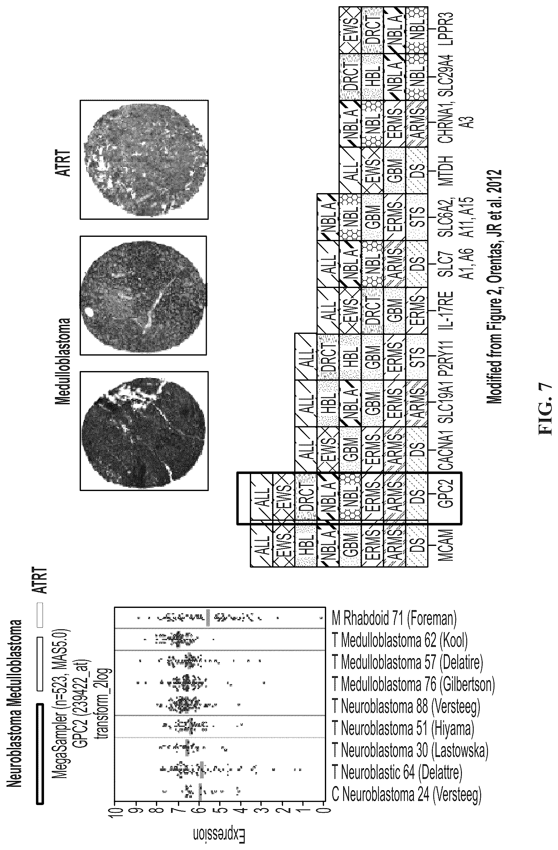 Patent US11814440 Figure 7 – Glypican 2 as a cancer marker and therapeutic target