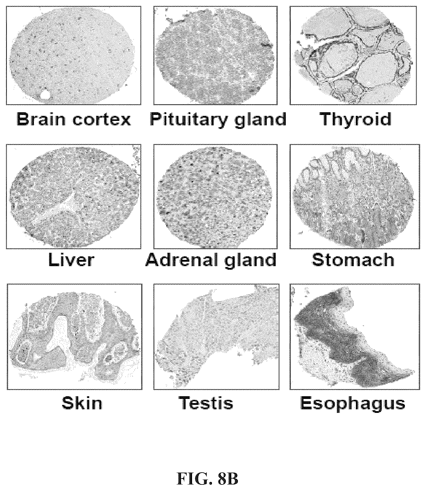 Patent US11814440 Figure 10 – Glypican 2 as a cancer marker and therapeutic target