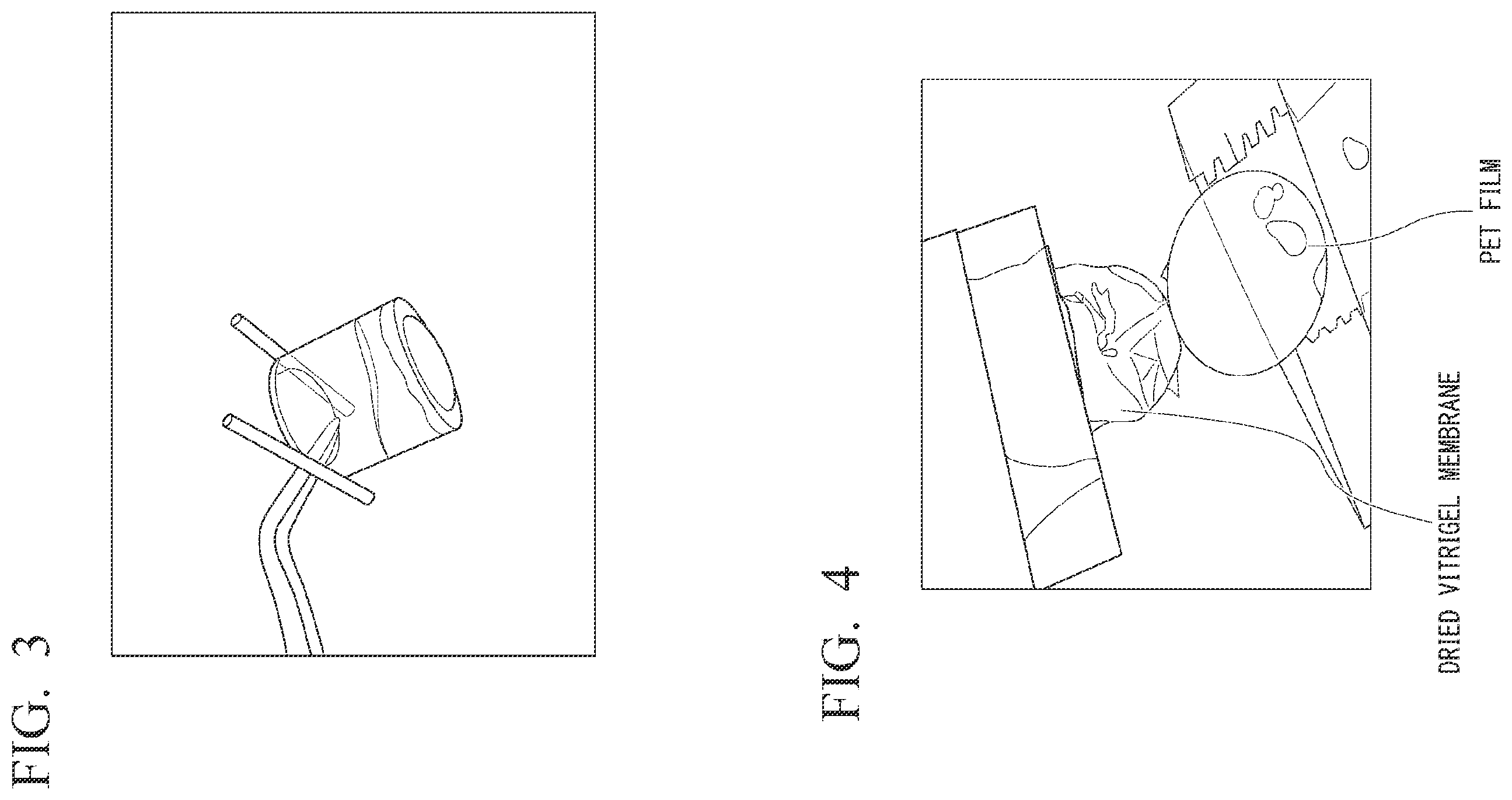 Patent US11814488 Figure 4 – Production method and production apparatus for dried vitrigel membrane