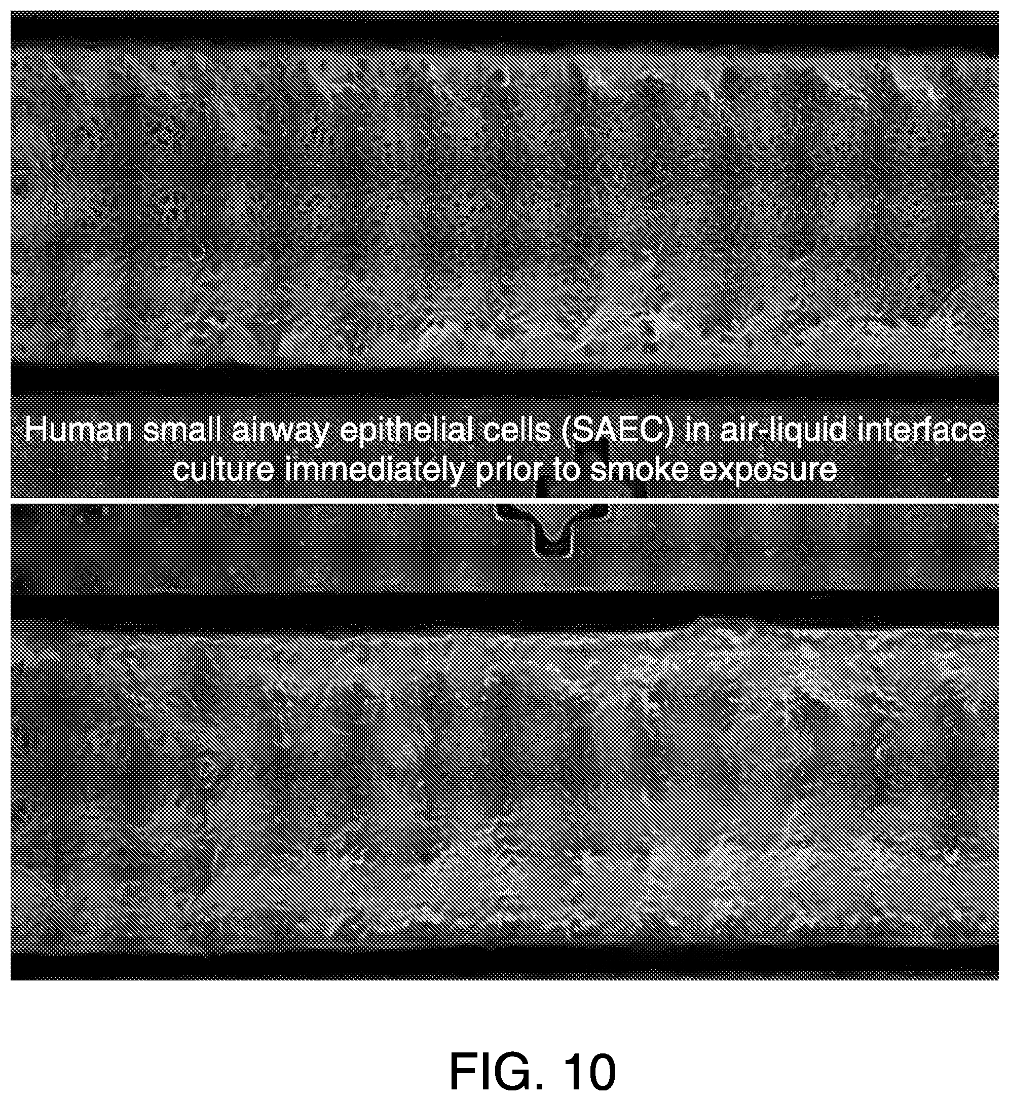 Patent US11814613 Figure 8 – Lung disease models on a chip