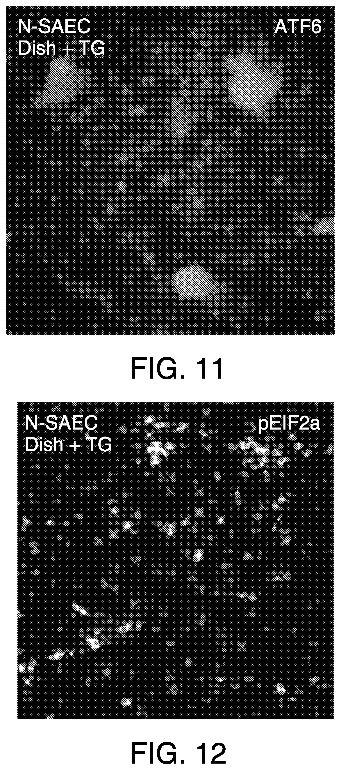 Patent US11814613 Figure 9 – Lung disease models on a chip