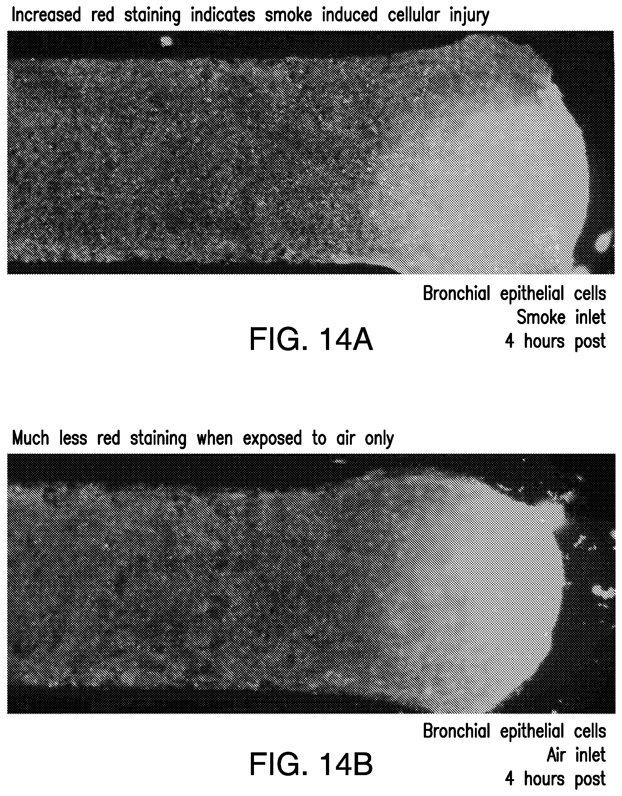 Patent US11814613 Figure 11 – Lung disease models on a chip