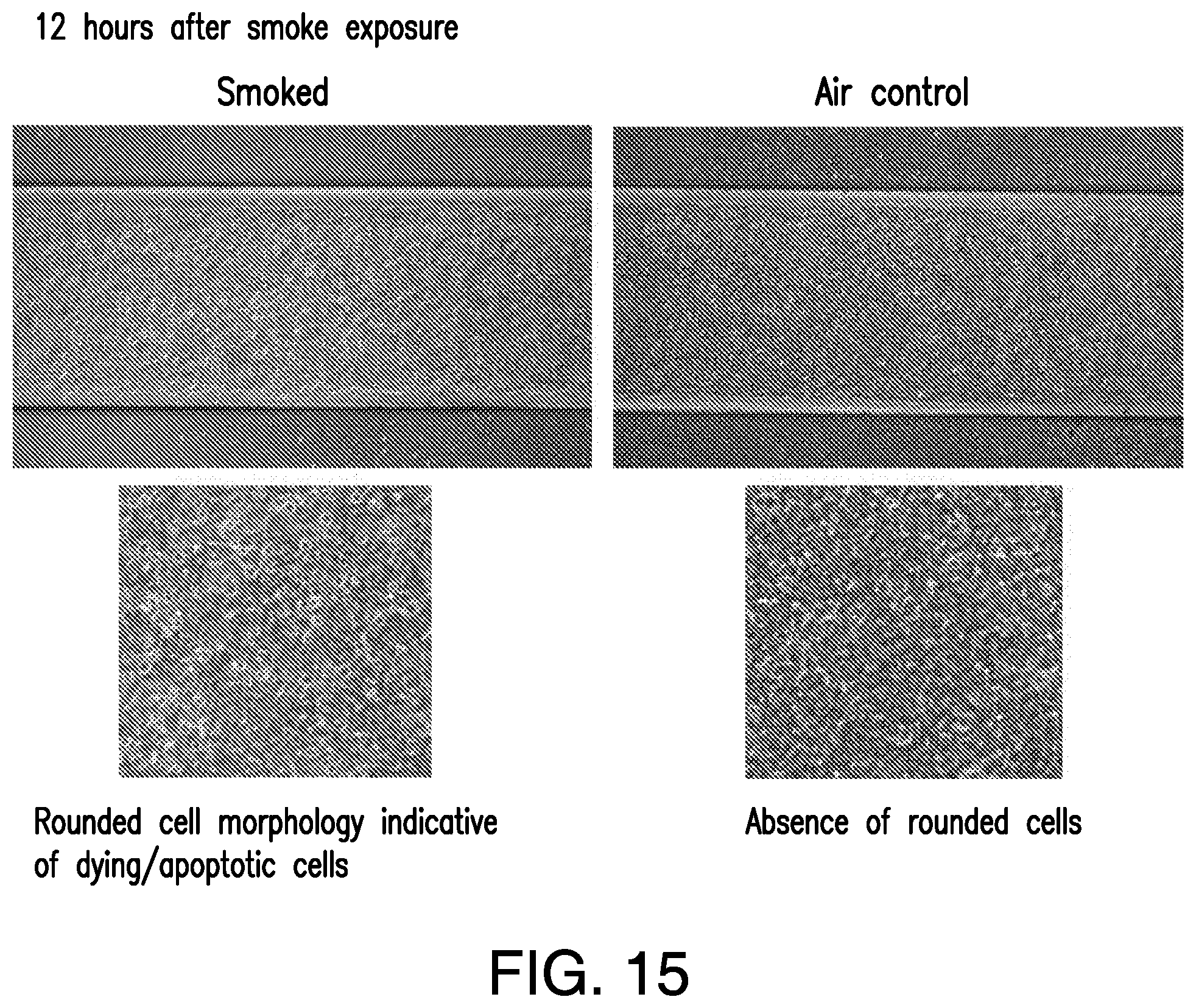 Patent US11814613 Figure 12 – Lung disease models on a chip