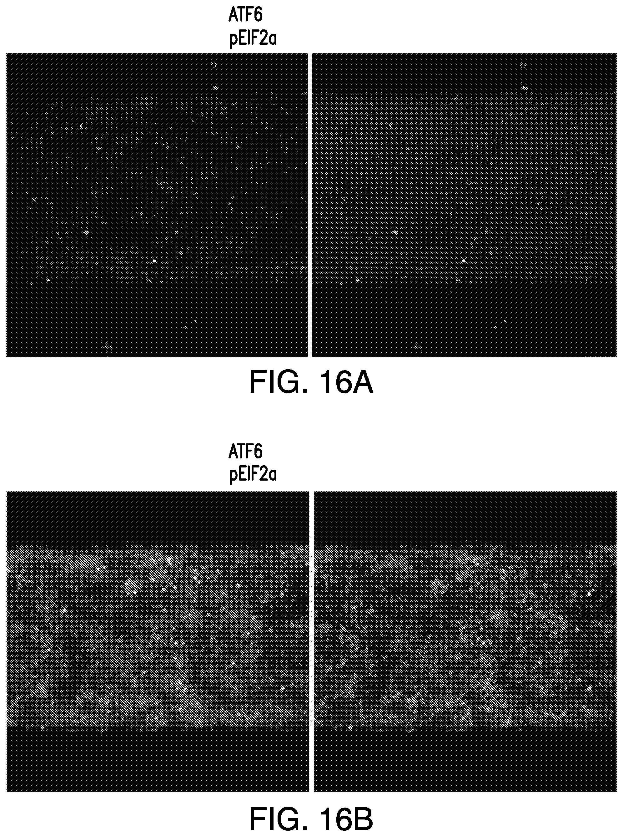 Patent US11814613 Figure 13 – Lung disease models on a chip