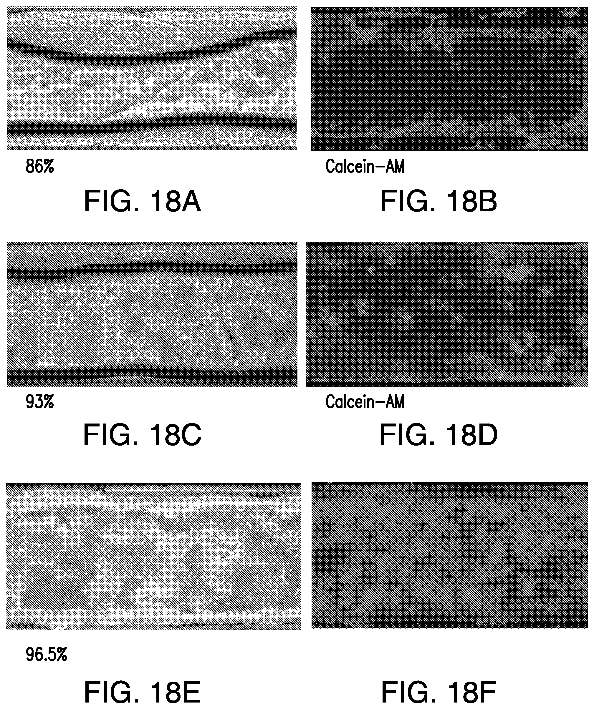 Patent US11814613 Figure 15 – Lung disease models on a chip