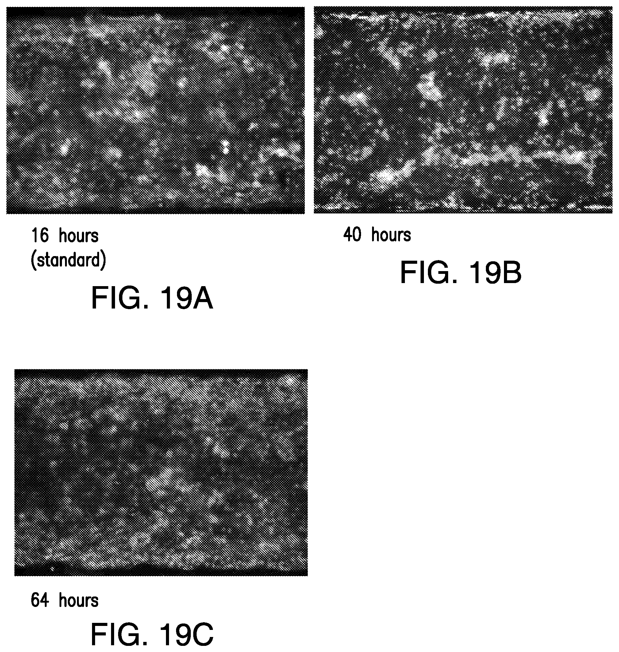 Patent US11814613 Figure 16 – Lung disease models on a chip