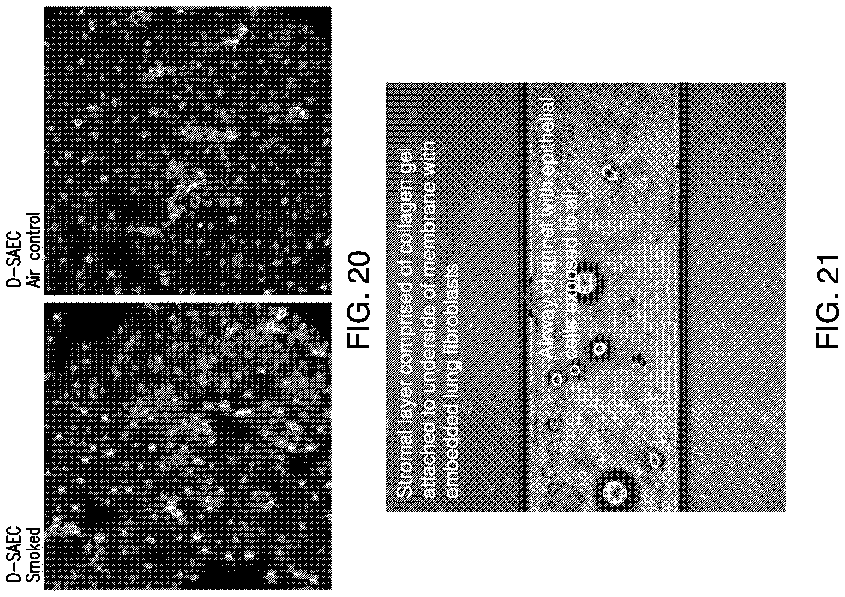 Patent US11814613 Figure 17 – Lung disease models on a chip