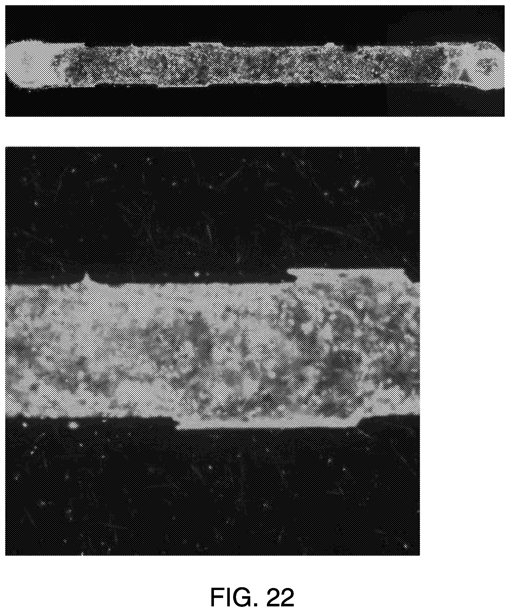 Patent US11814613 Figure 18 – Lung disease models on a chip