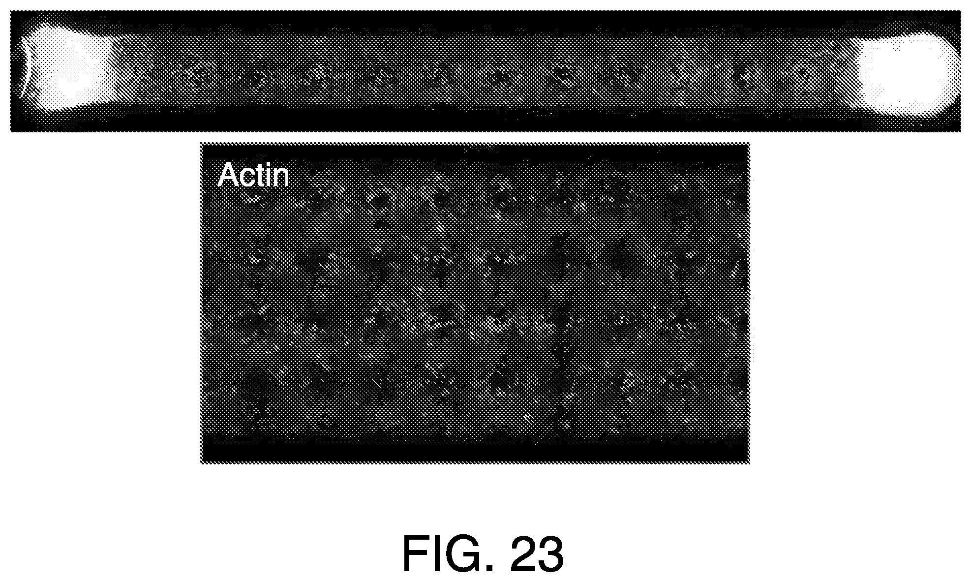 Patent US11814613 Figure 19 – Lung disease models on a chip