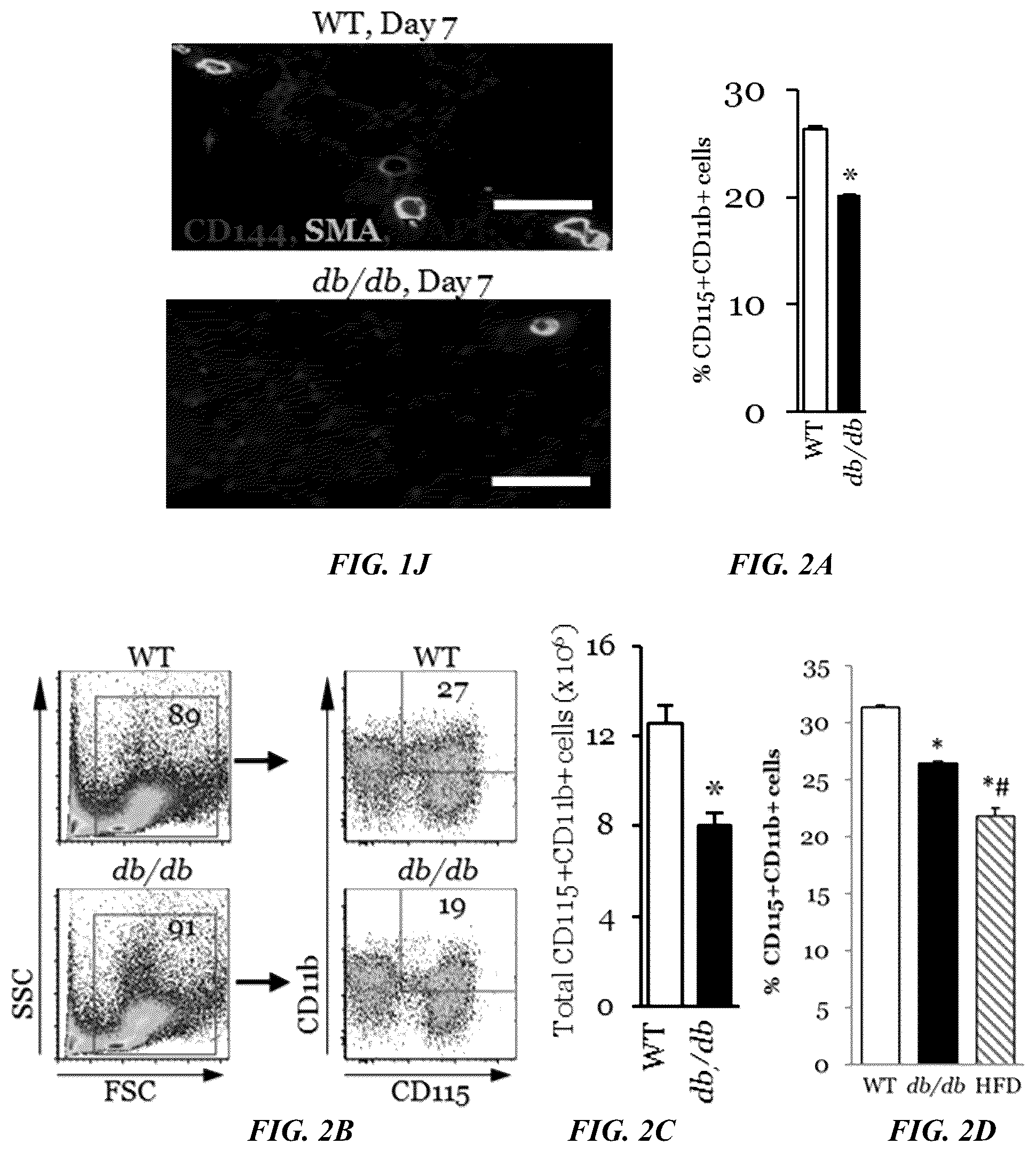 Patent US11814623 Figure 3 – Methods of treating a wound using epigenetic regulation