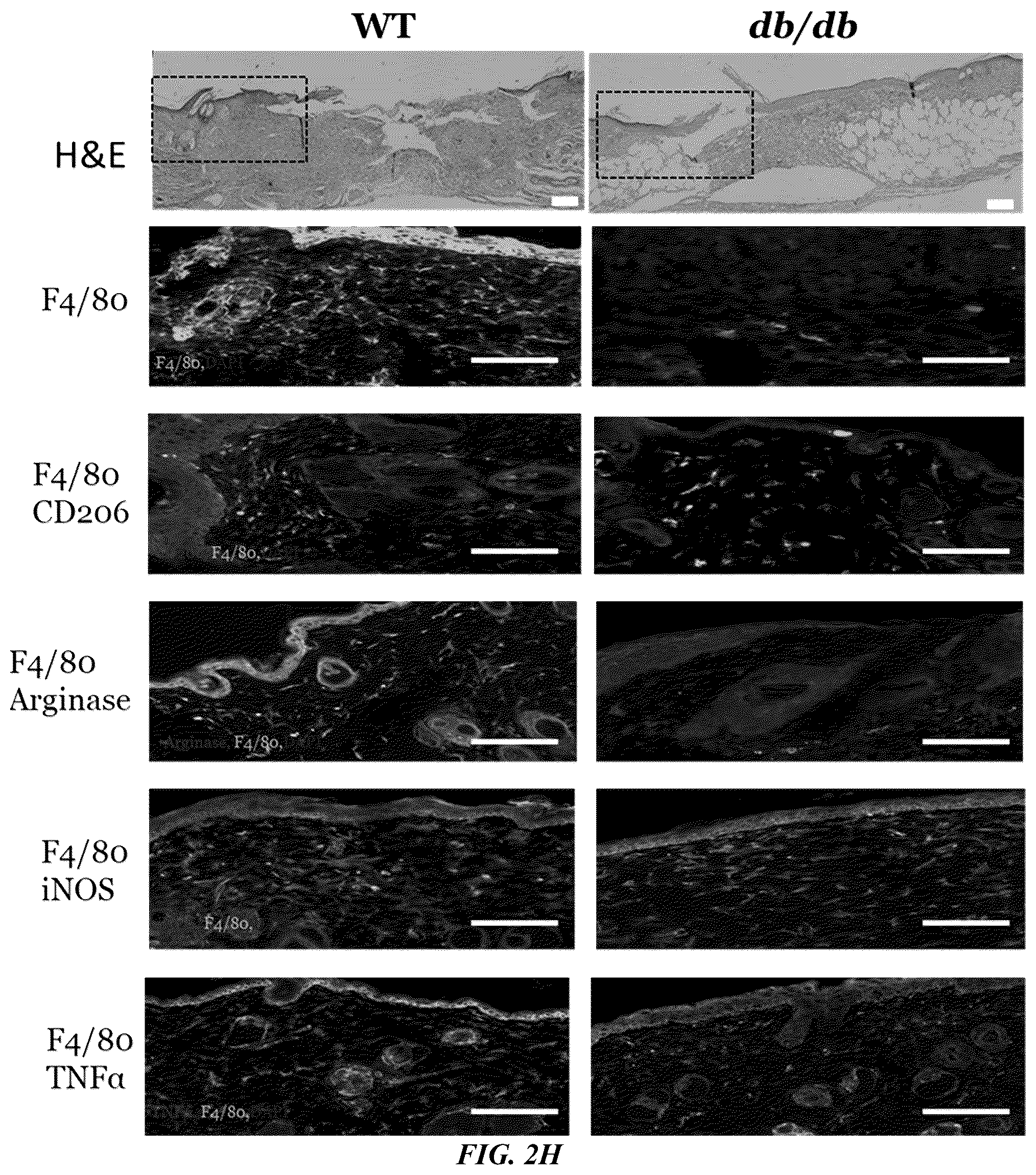 Patent US11814623 Figure 5 – Methods of treating a wound using epigenetic regulation