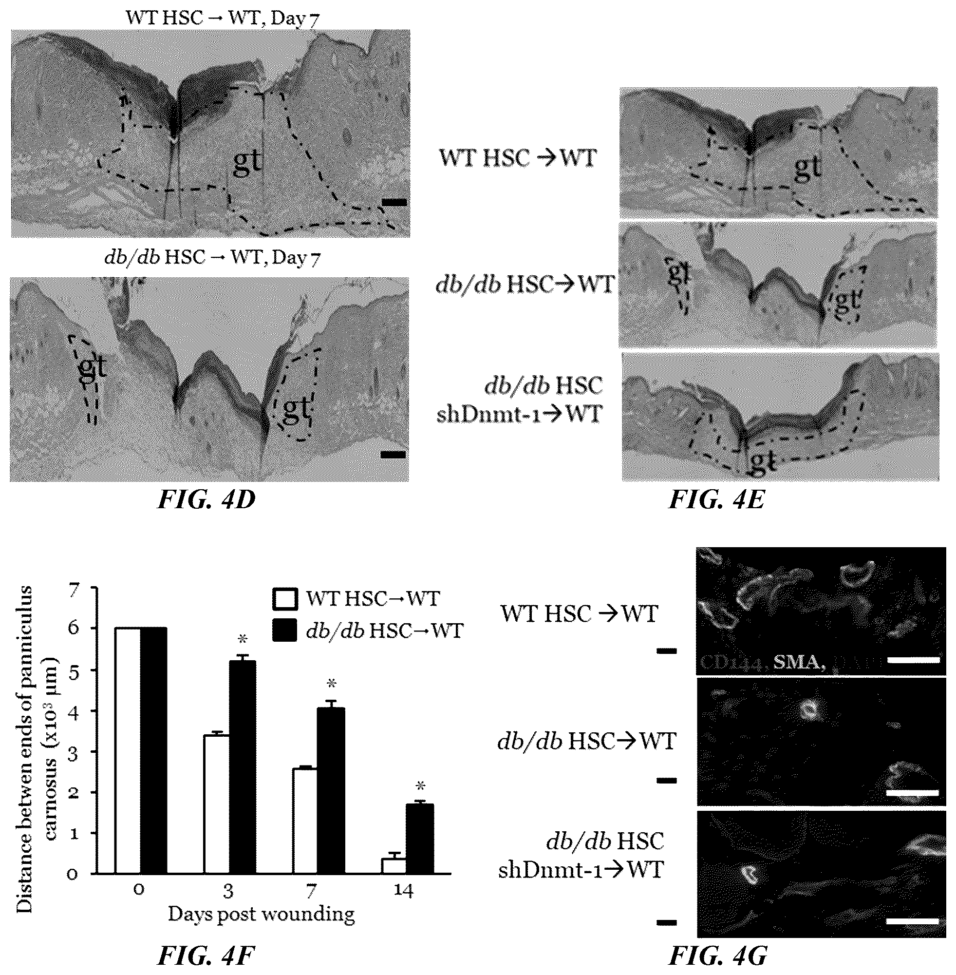 Patent US11814623 Figure 9 – Methods of treating a wound using epigenetic regulation