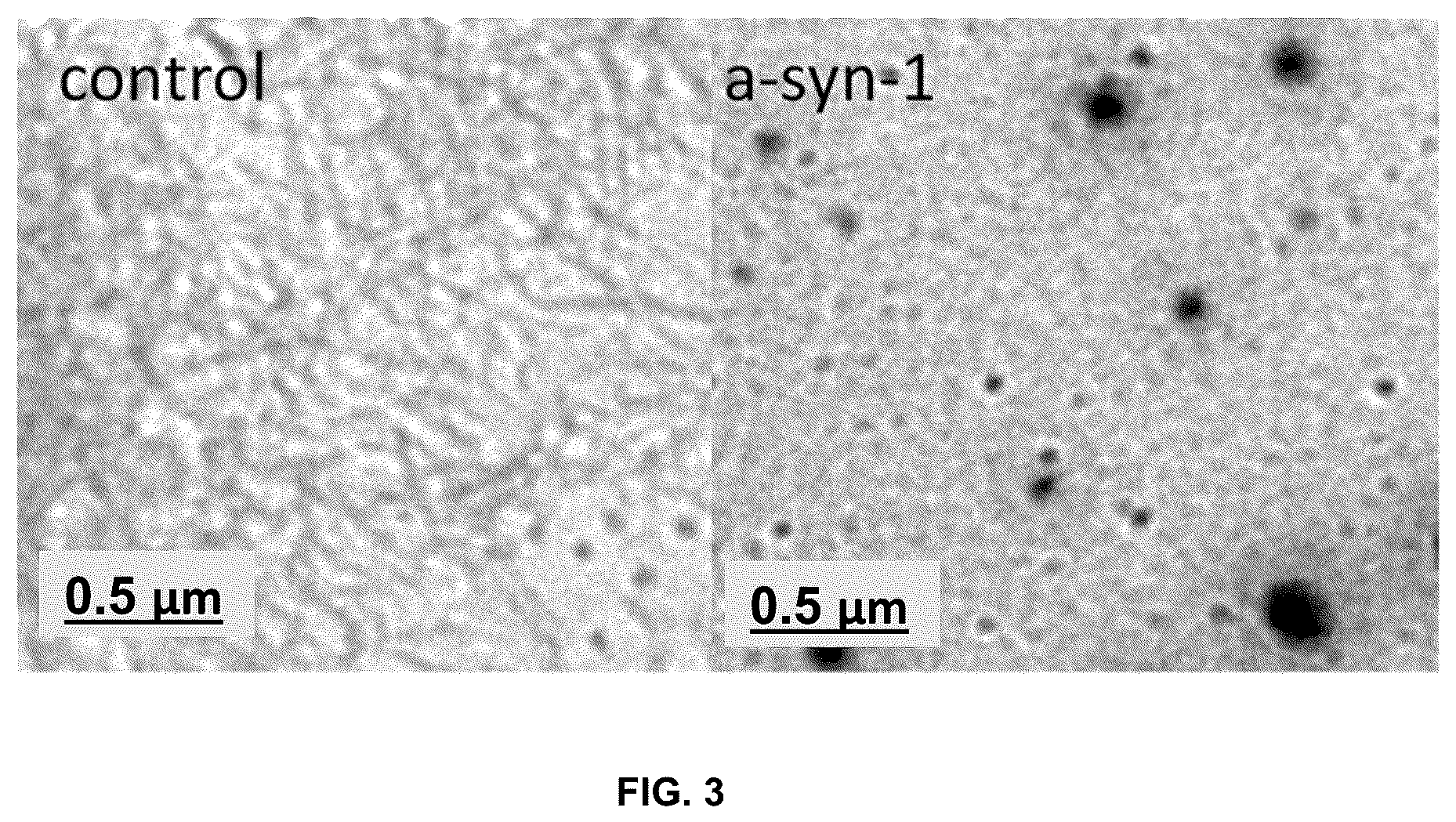 Patent US11814625 Figure 3 – Aptamers as a therapeutic tool to prevent protein aggregation in neurodegenerative disease