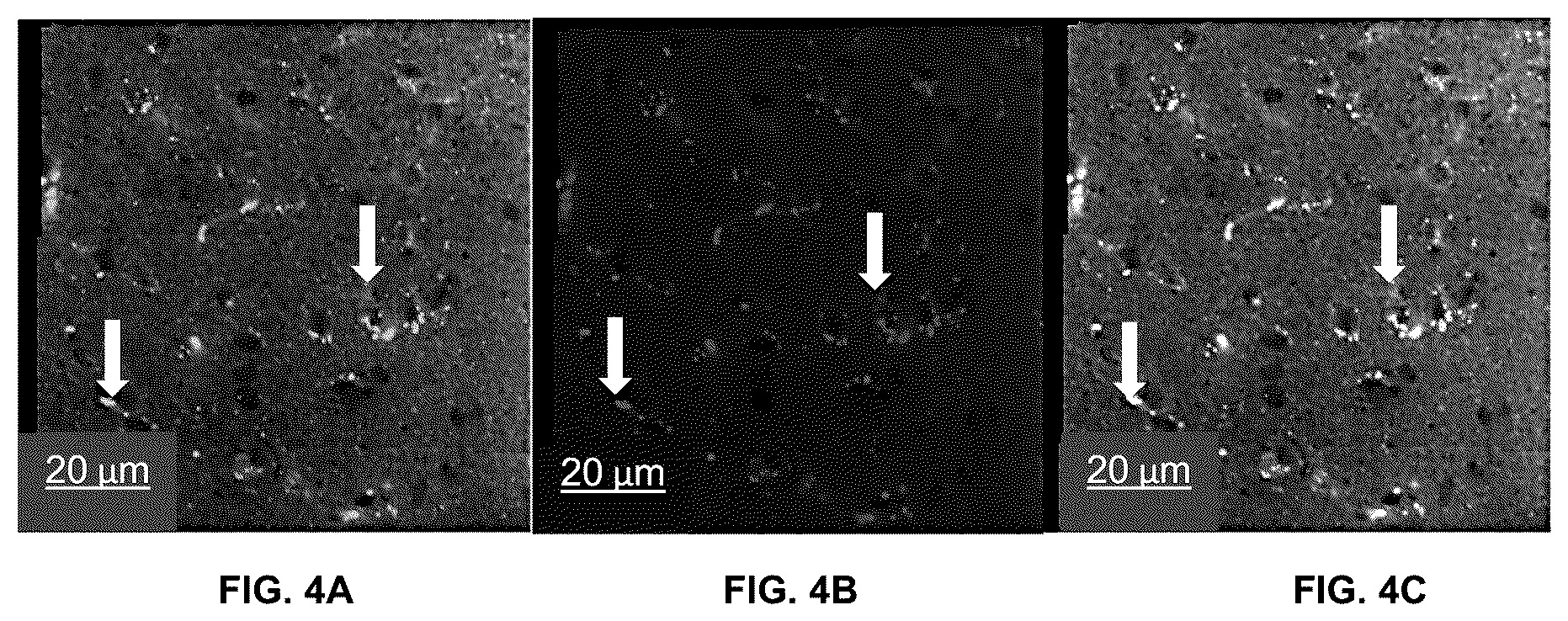 Patent US11814625 Figure 4 – Aptamers as a therapeutic tool to prevent protein aggregation in neurodegenerative disease