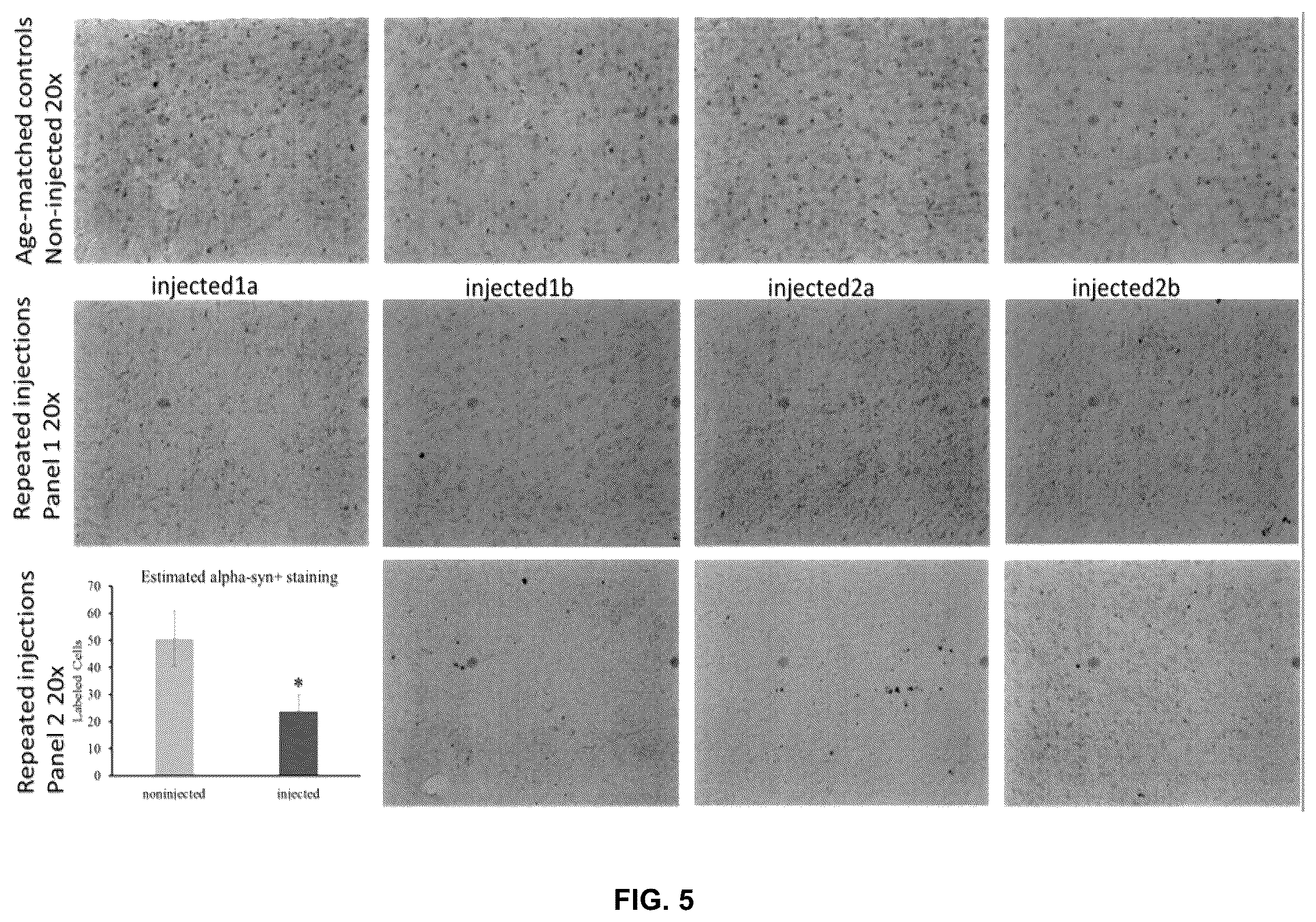 Patent US11814625 Figure 5 – Aptamers as a therapeutic tool to prevent protein aggregation in neurodegenerative disease