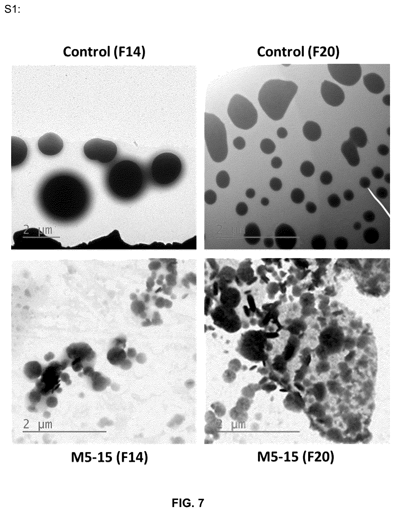 Patent US11814625 Figure 7 – Aptamers as a therapeutic tool to prevent protein aggregation in neurodegenerative disease