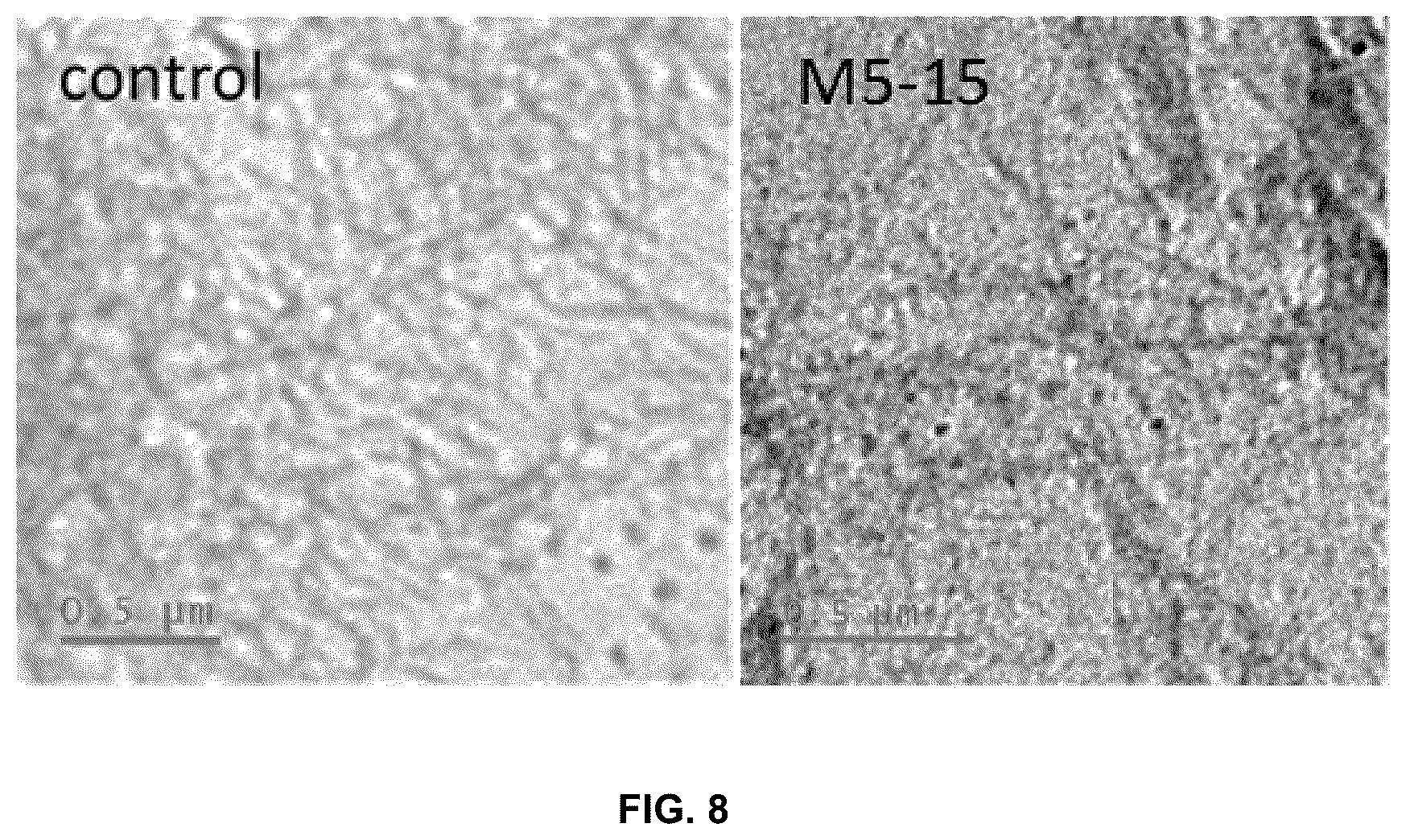 Patent US11814625 Figure 8 – Aptamers as a therapeutic tool to prevent protein aggregation in neurodegenerative disease