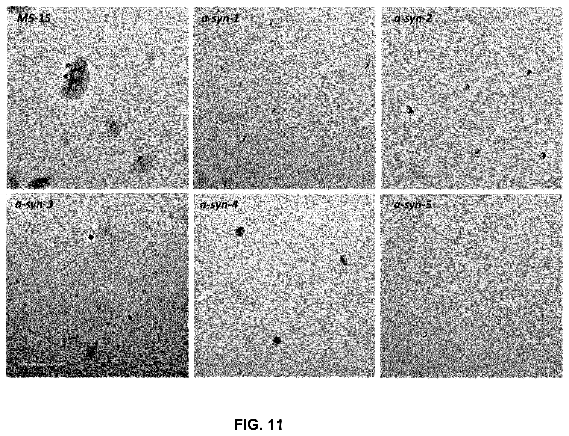 Patent US11814625 Figure 11 – Aptamers as a therapeutic tool to prevent protein aggregation in neurodegenerative disease