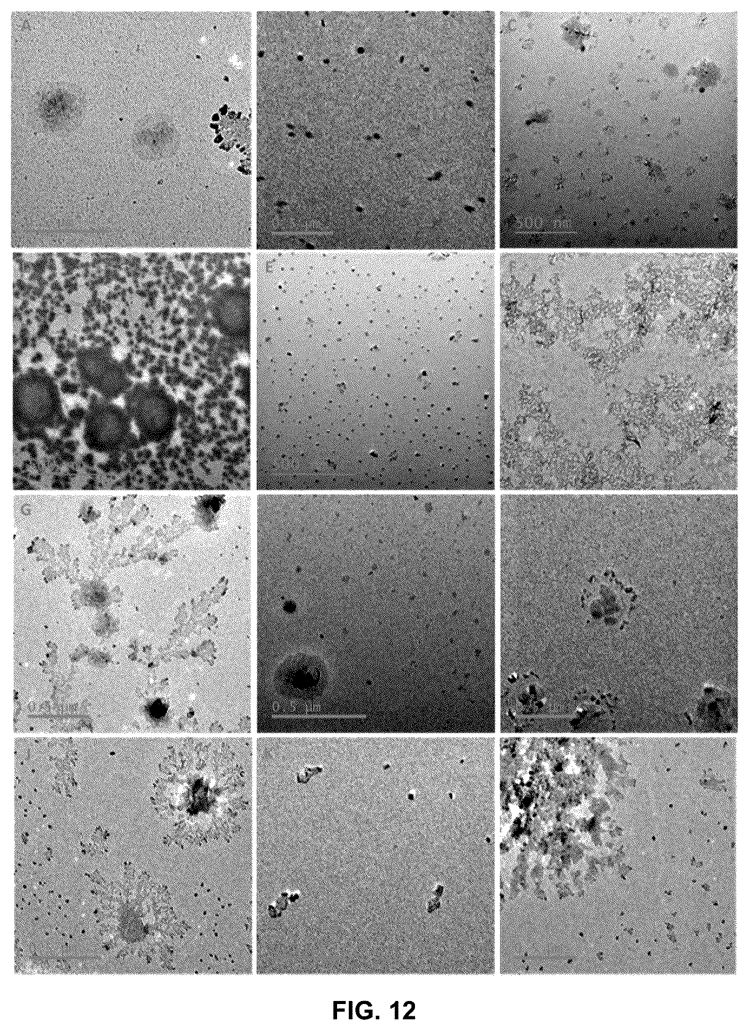 Patent US11814625 Figure 12 – Aptamers as a therapeutic tool to prevent protein aggregation in neurodegenerative disease