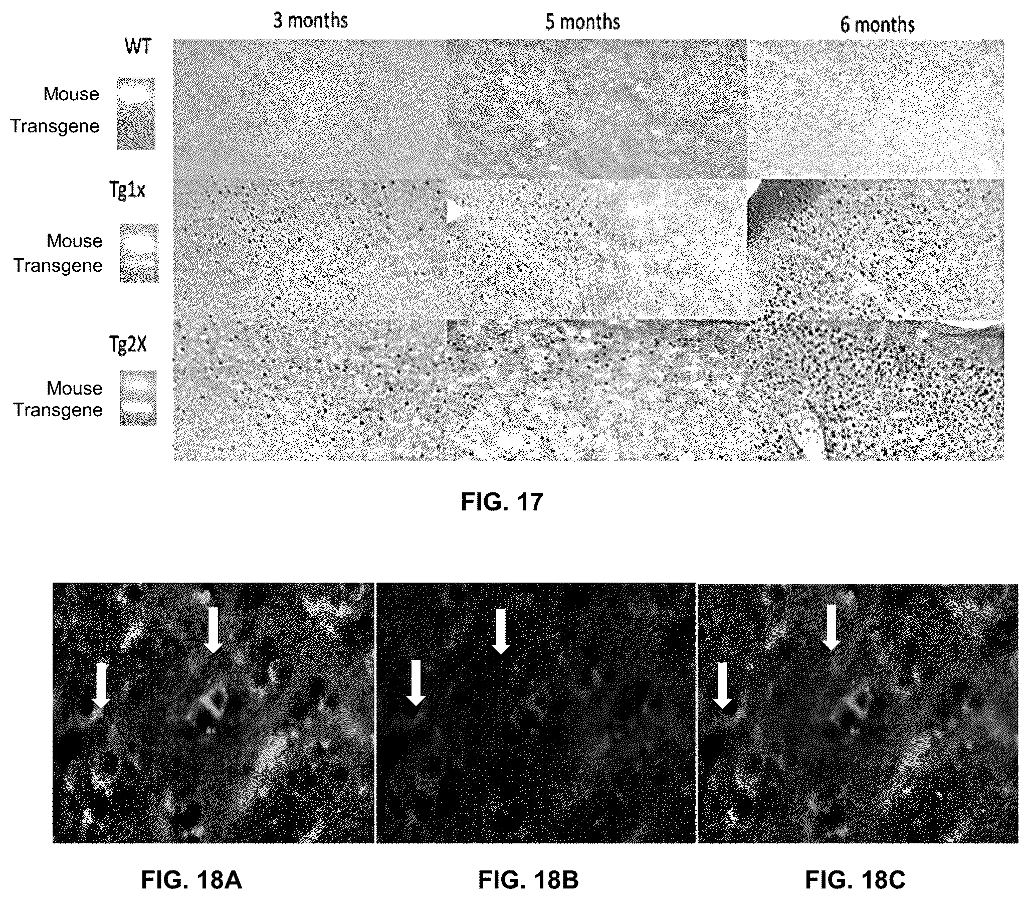 Patent US11814625 Figure 16 – Aptamers as a therapeutic tool to prevent protein aggregation in neurodegenerative disease