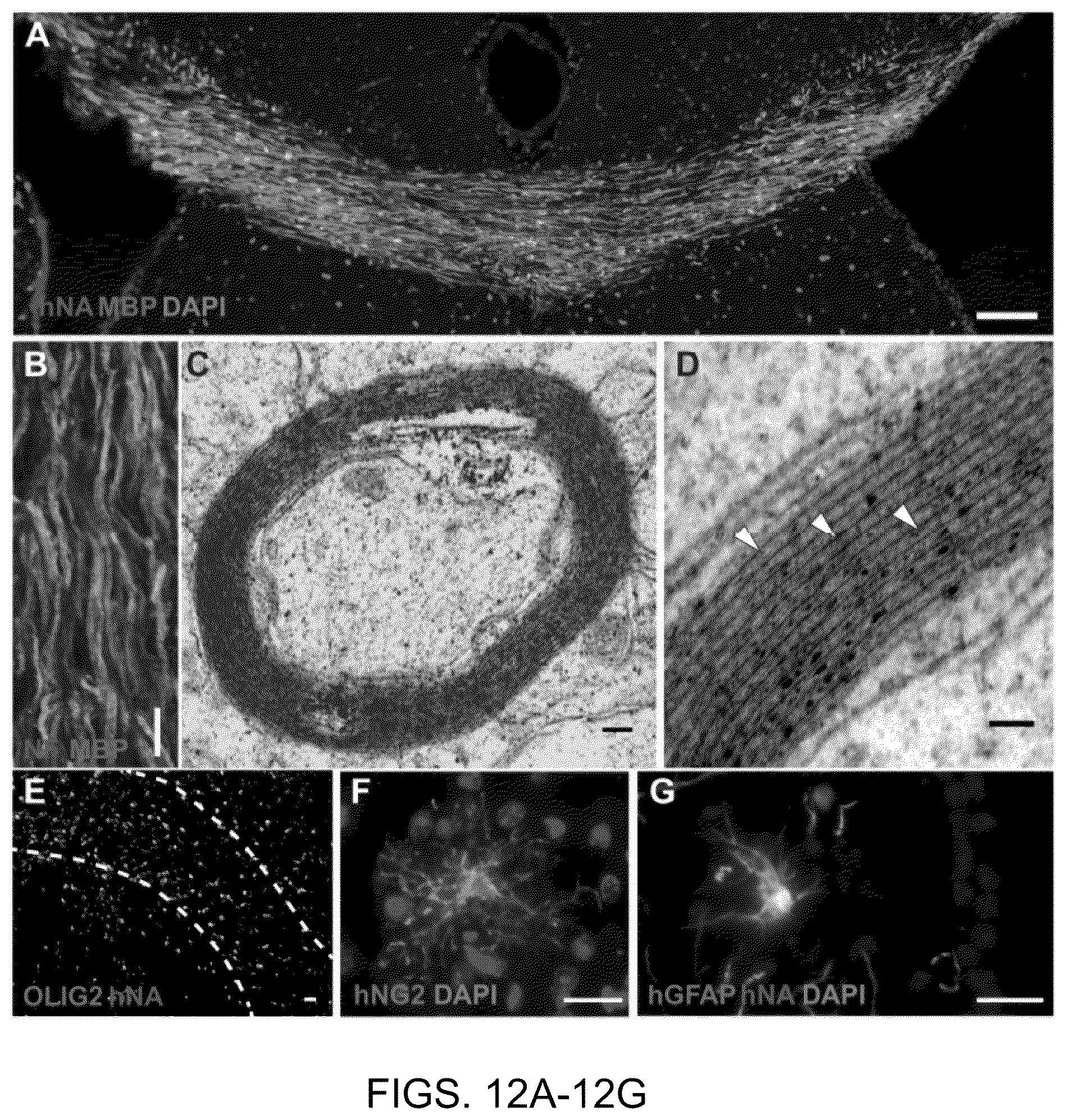 Patent US11814648 Figure 12 – Functional oligodendrocytes derived from pluripotent stem cells and methods of making and using the same