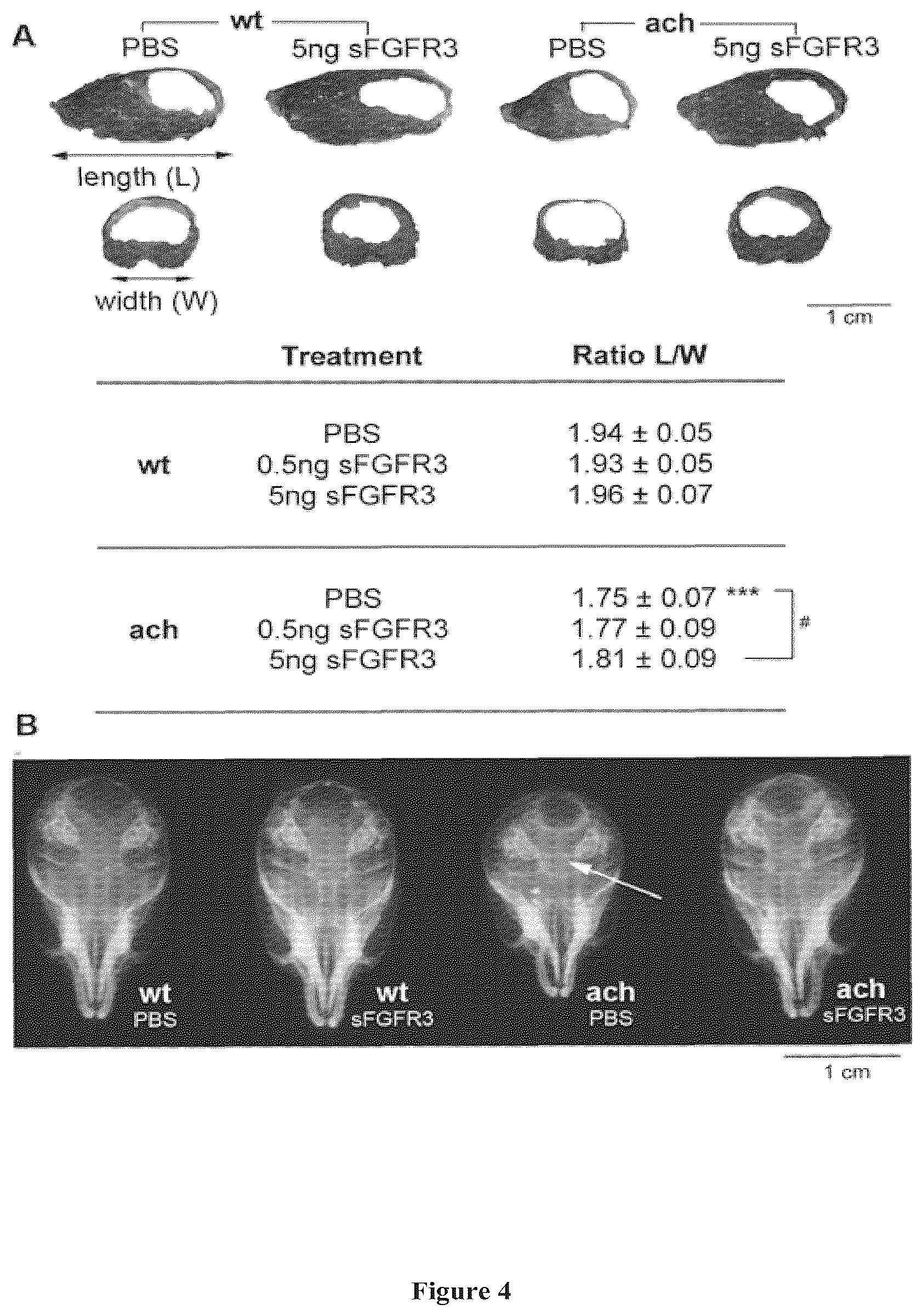 Patent US11814654 Figure 4 – Soluble fibroblast growth factor receptor 3 (FGR3) polypeptide for use in the prevention or treatment of skeletal growth retardation disorders