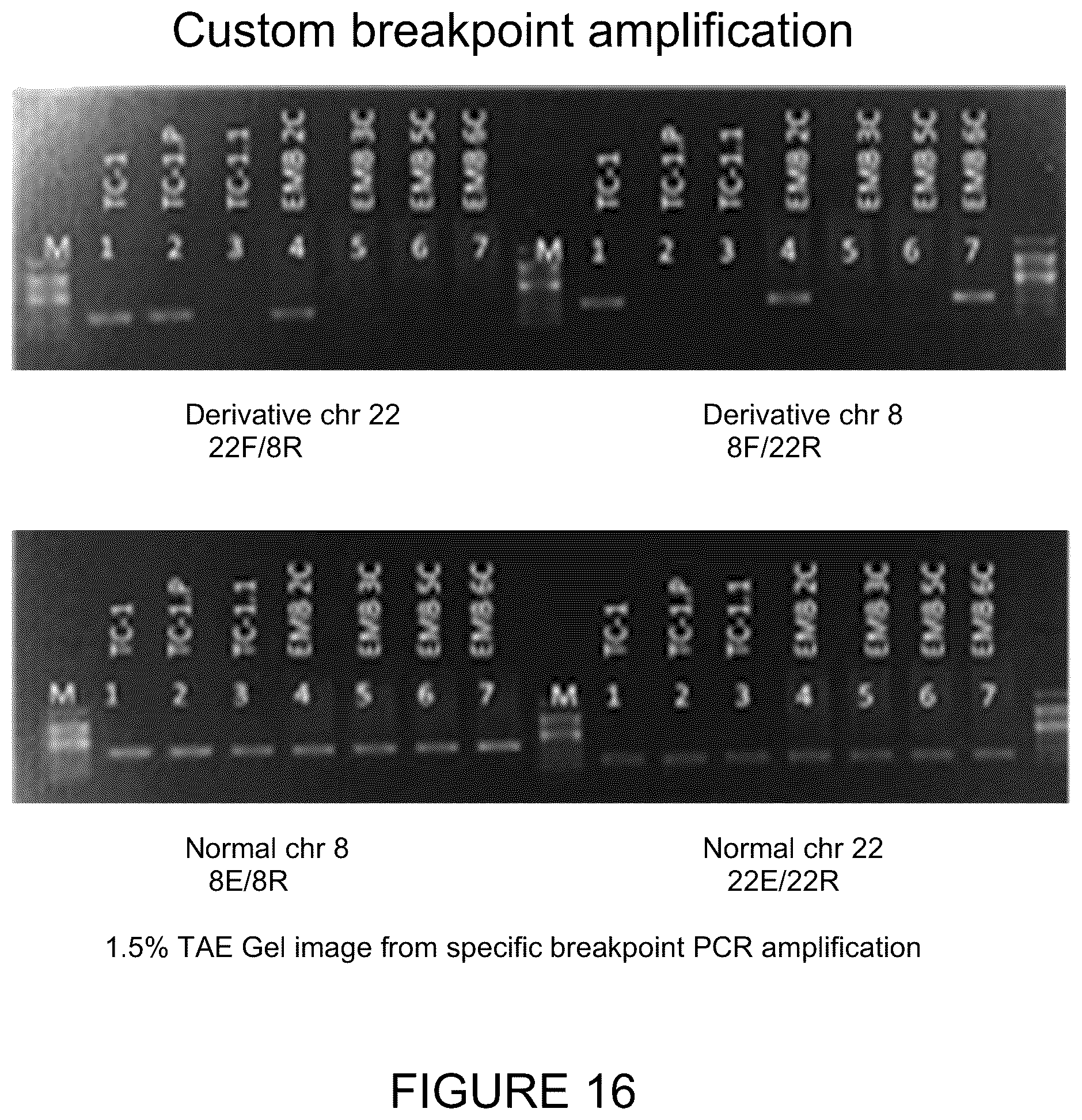 Patent US11814682 Figure 16 – Method for preimplantation genetic screening of embryos for detection of structural rearrangements
