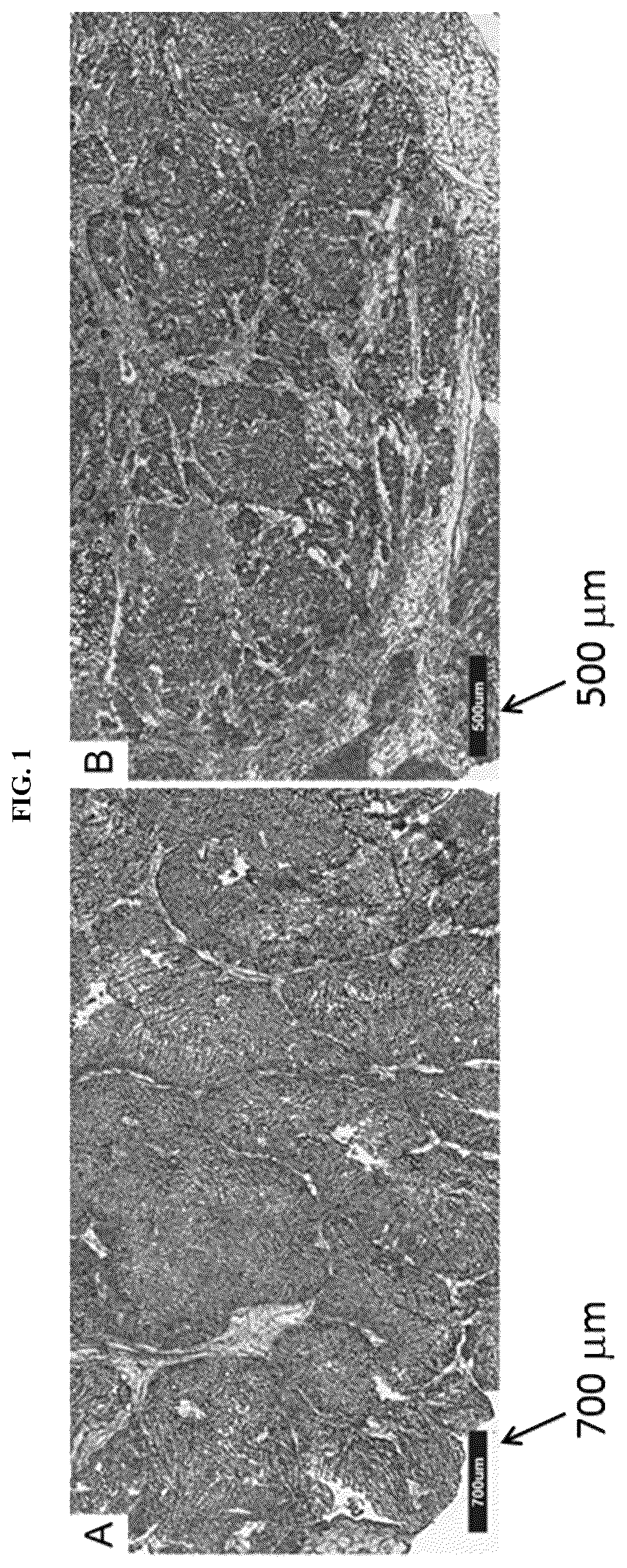 Patent US11814687 Figure 1 – Methods for characterizing bladder cancer