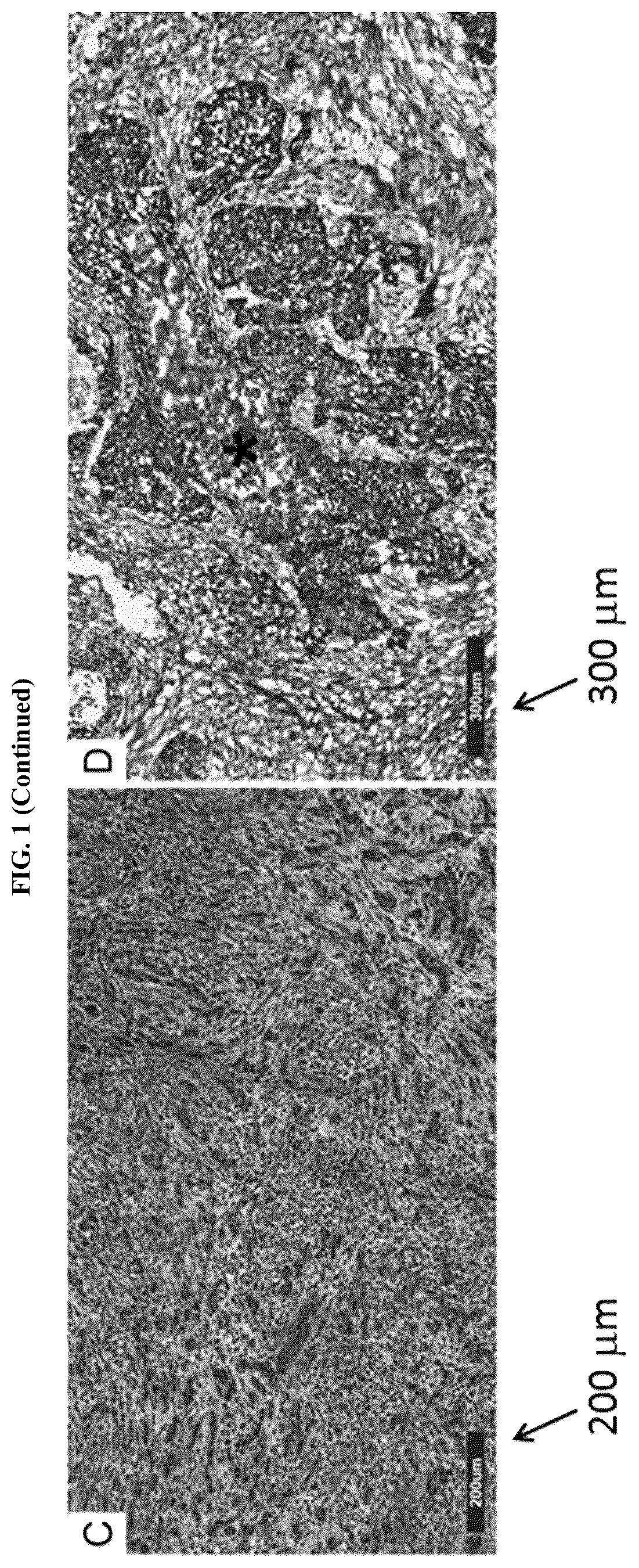 Patent US11814687 Figure 2 – Methods for characterizing bladder cancer